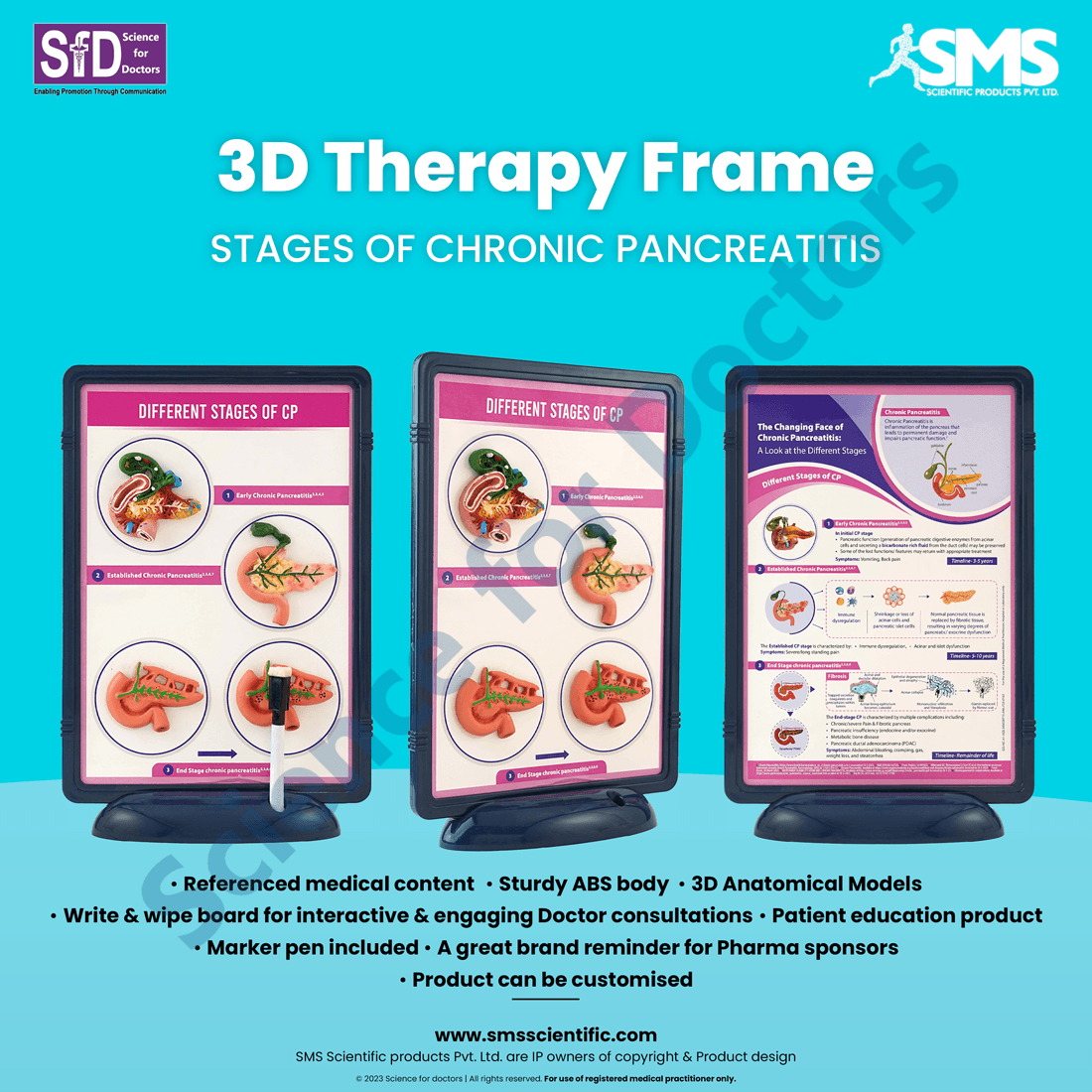 Stages of Chronic Pancreatitis: 3D Therapy Frame