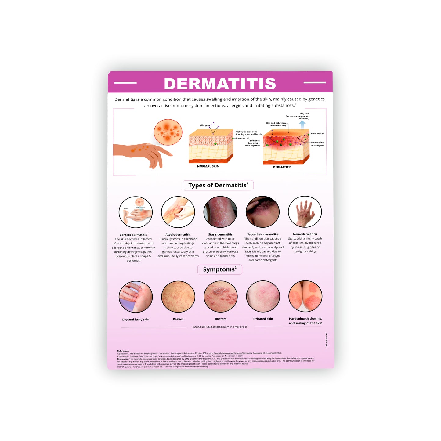 Dermatitis: Therapy Board