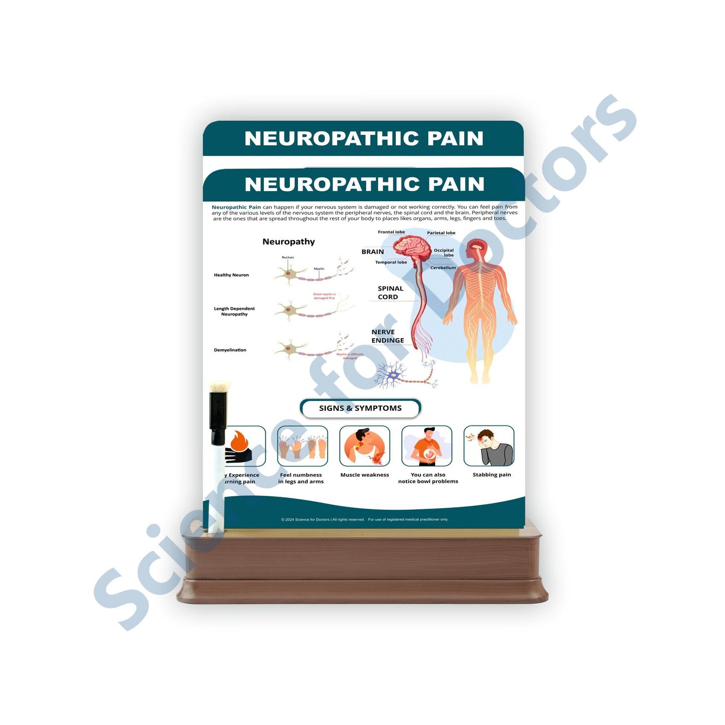 Neuropathic Pain: 2 Slides on stand