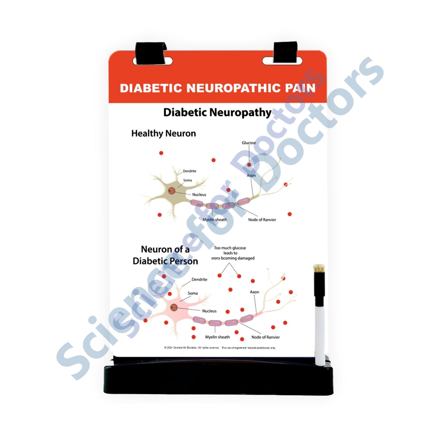 Diabetic Neuropathic Pain: A4 Flip Wipe