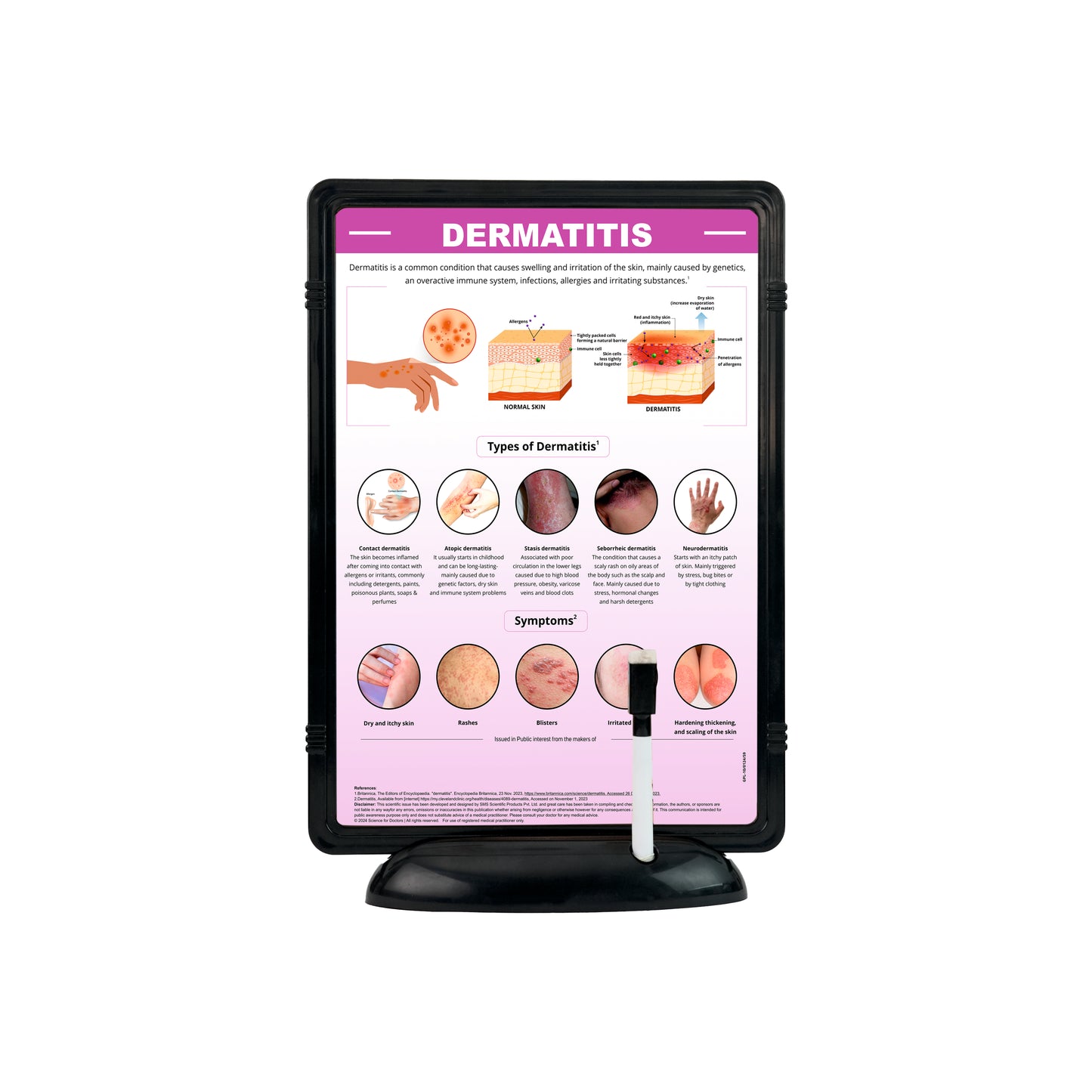 Dermatitis: The Frame Write & Wipe