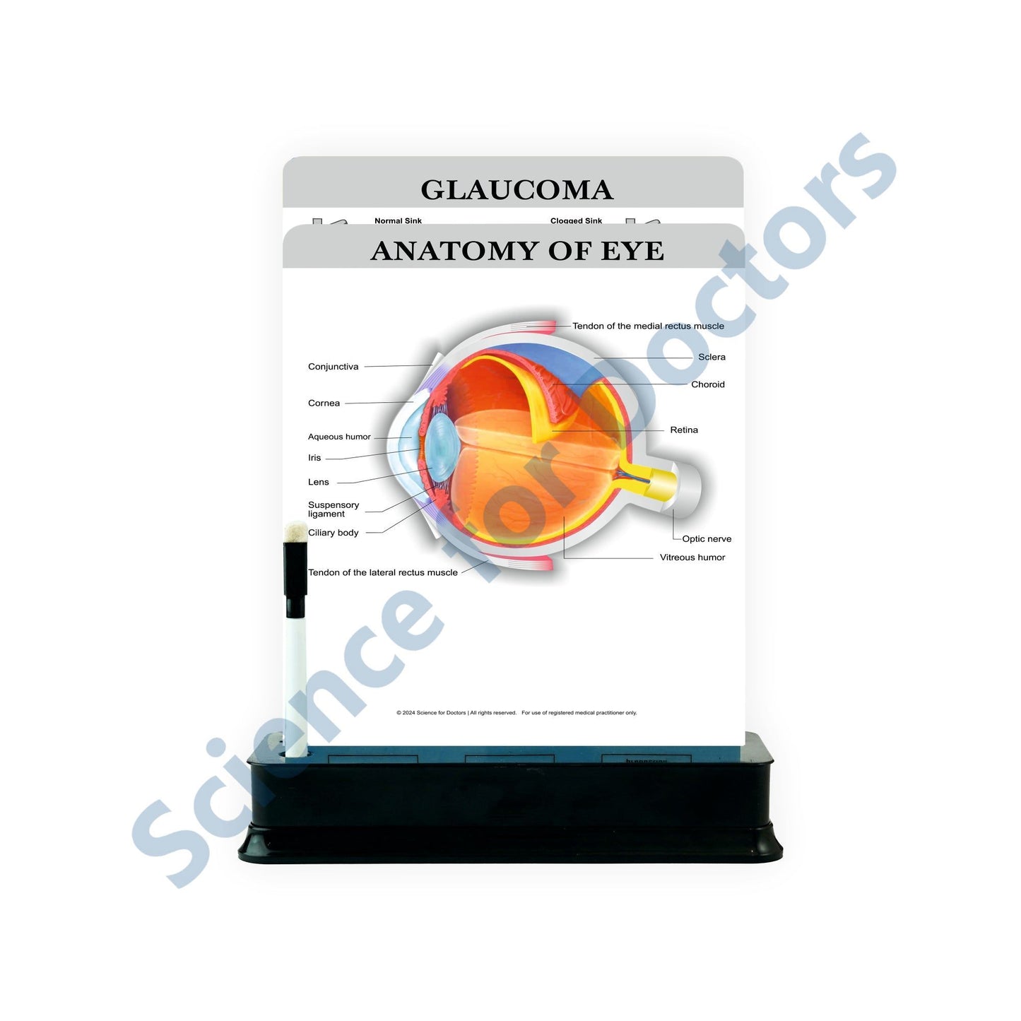 Anatomy of Eye - 2 Slides With Stand