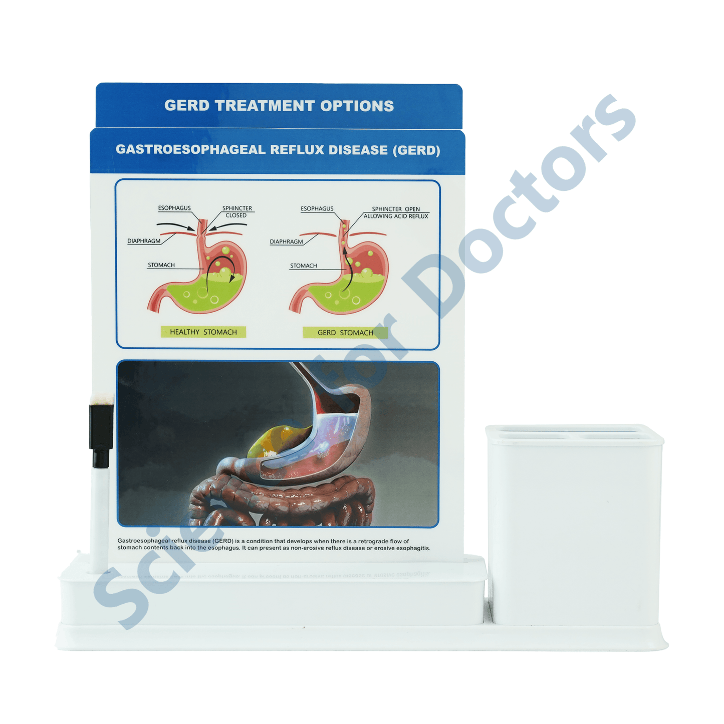 GERD: 2 slide on stand with Stationary stand