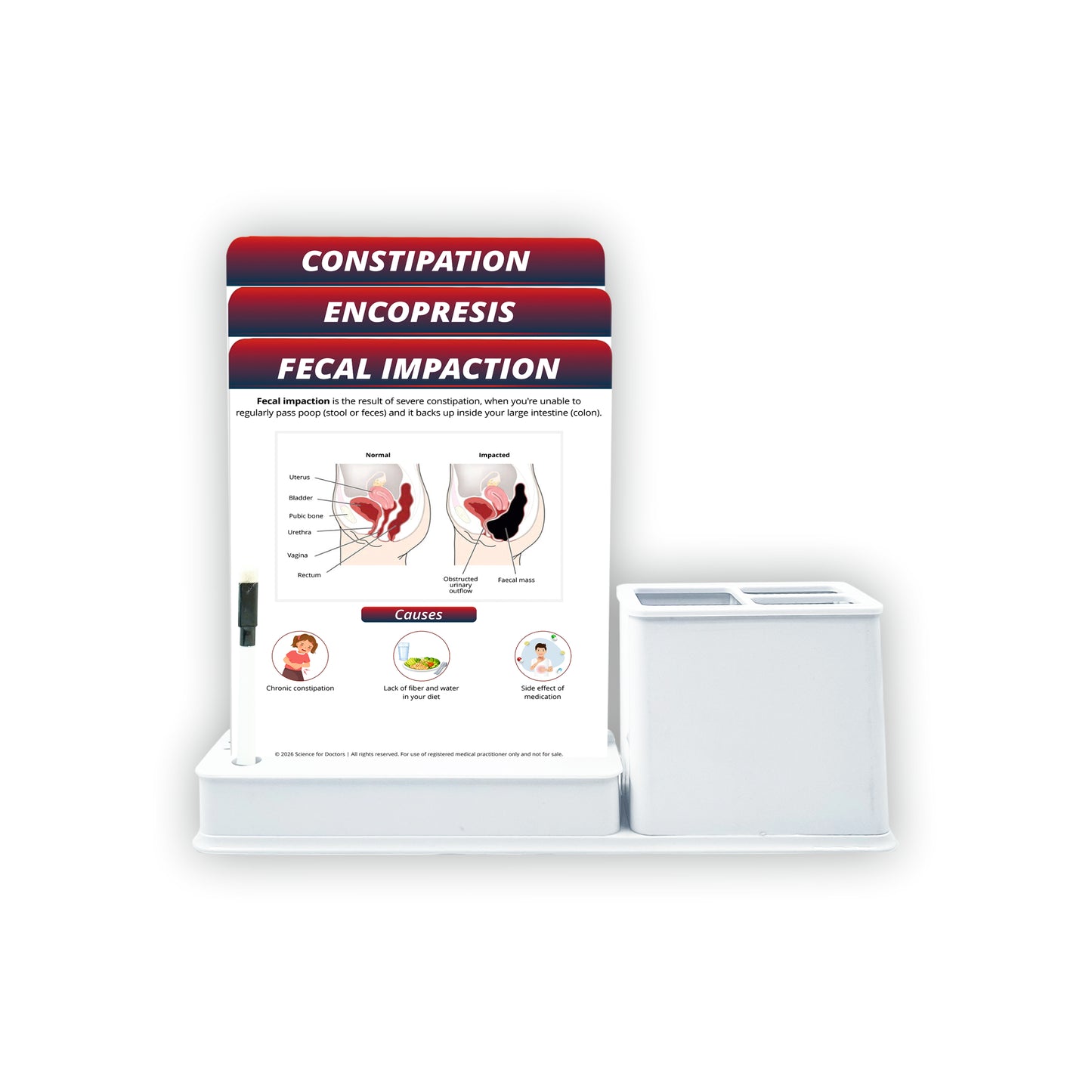 Smart - 3 Slides Write & Wipe With Stationary Stand - Fecal Impaction