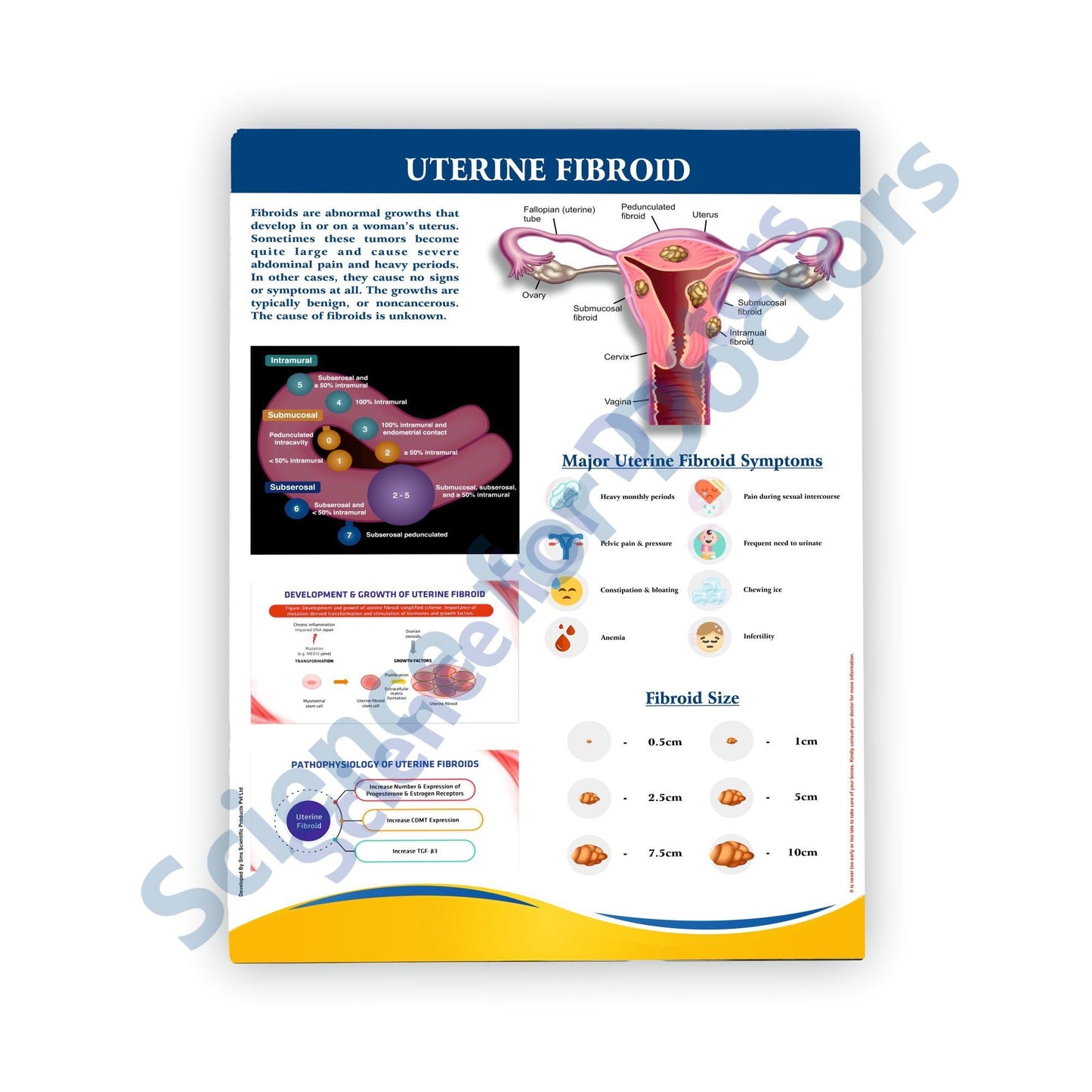 Uterine Fibroid: Therapy Board