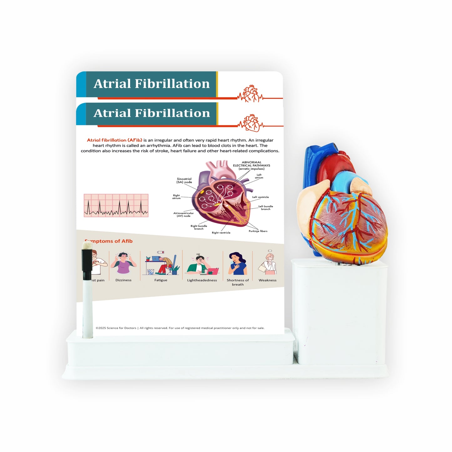 Atrial Fibrillation: 2 Slides Write & Wipe With Model On Stand