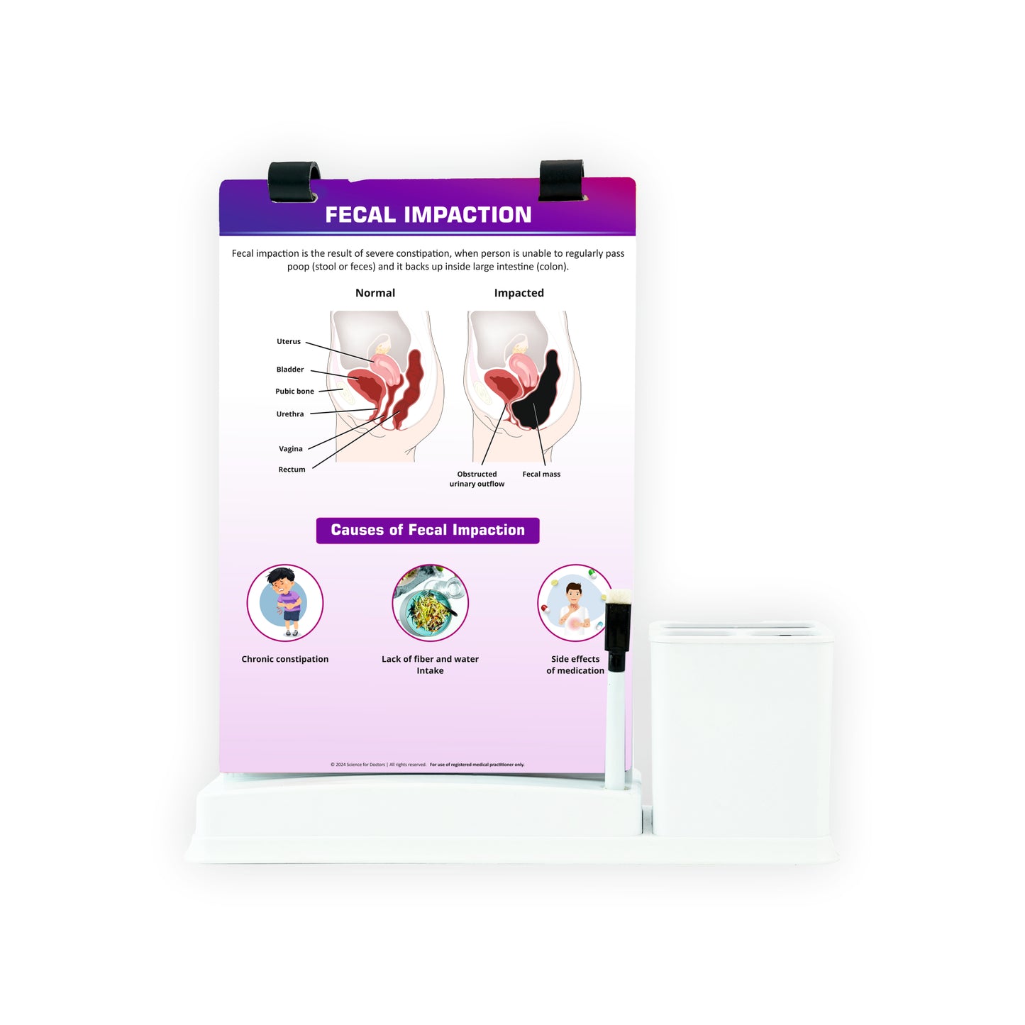 Fecal Impaction: A4 Flip Wipe With Stationary Stand