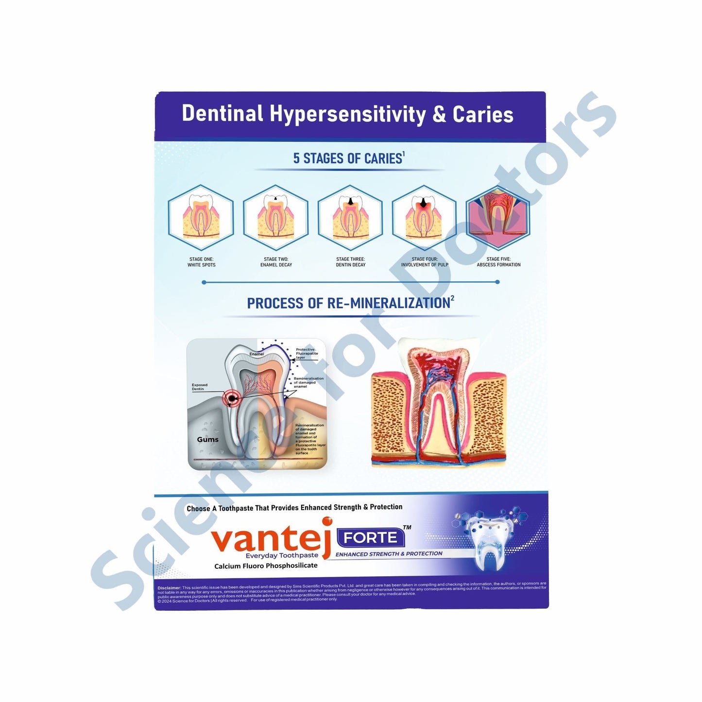 Dental Hypersensitivity & Caries: 3D Therapy Board