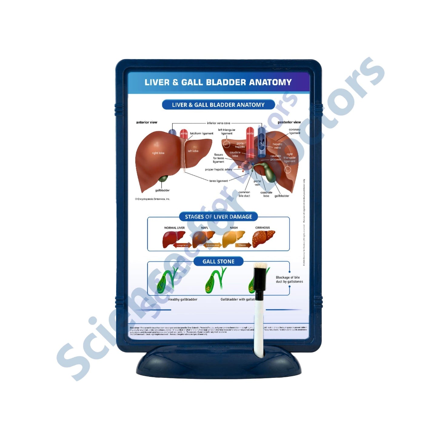 Liver & Gall Bladder Anatomy: The Frame Write & Wipe