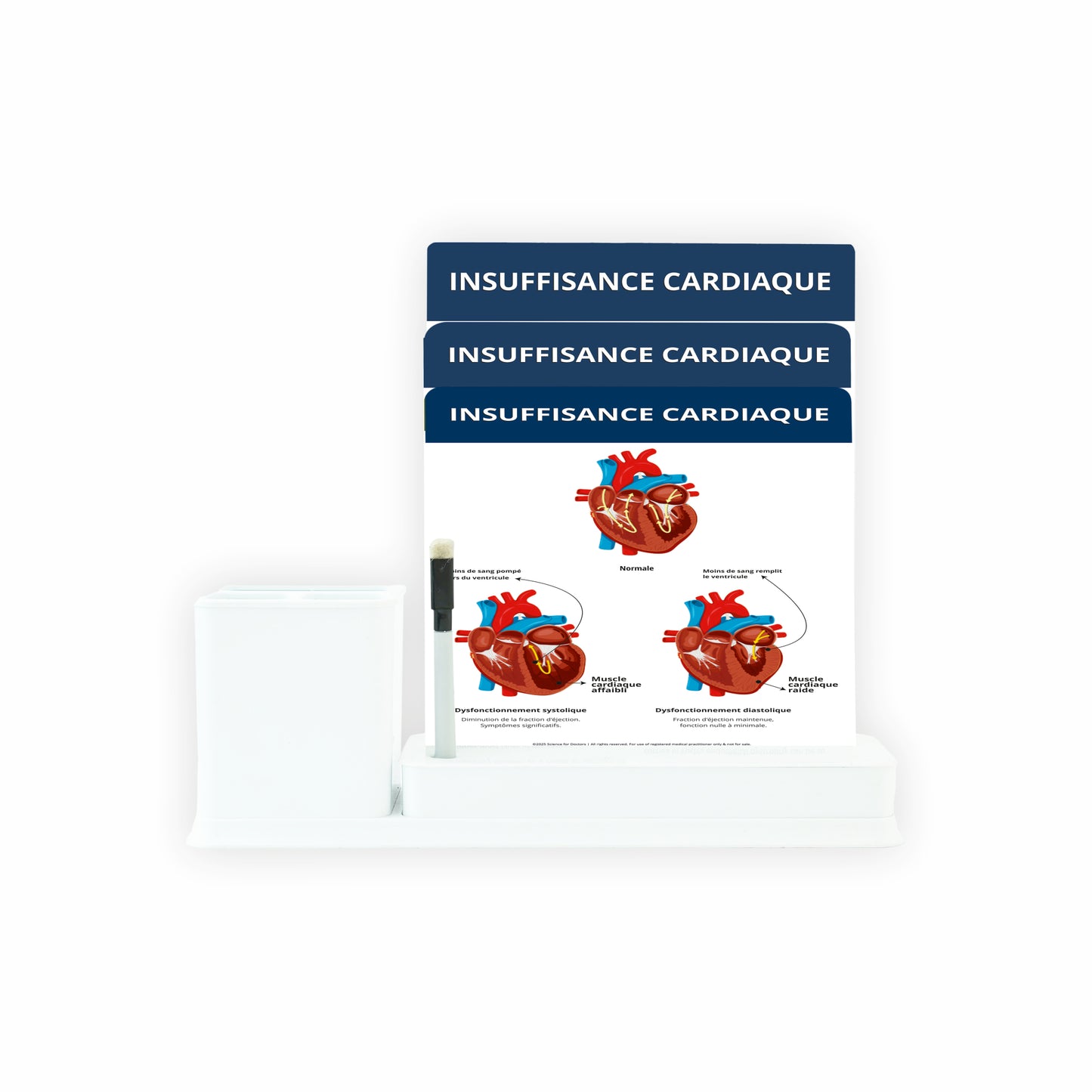 Insuffisance Cardiaque: 3 Slides Write & Wipe with Stationary Stand