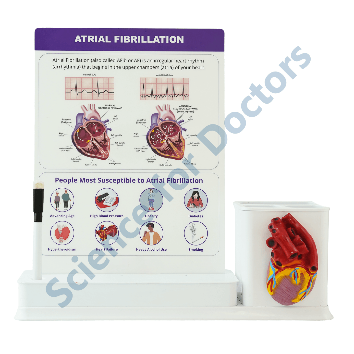 Atrial Fibrillation : 1 Slide Write and wipe with anatomical model on stationery stand