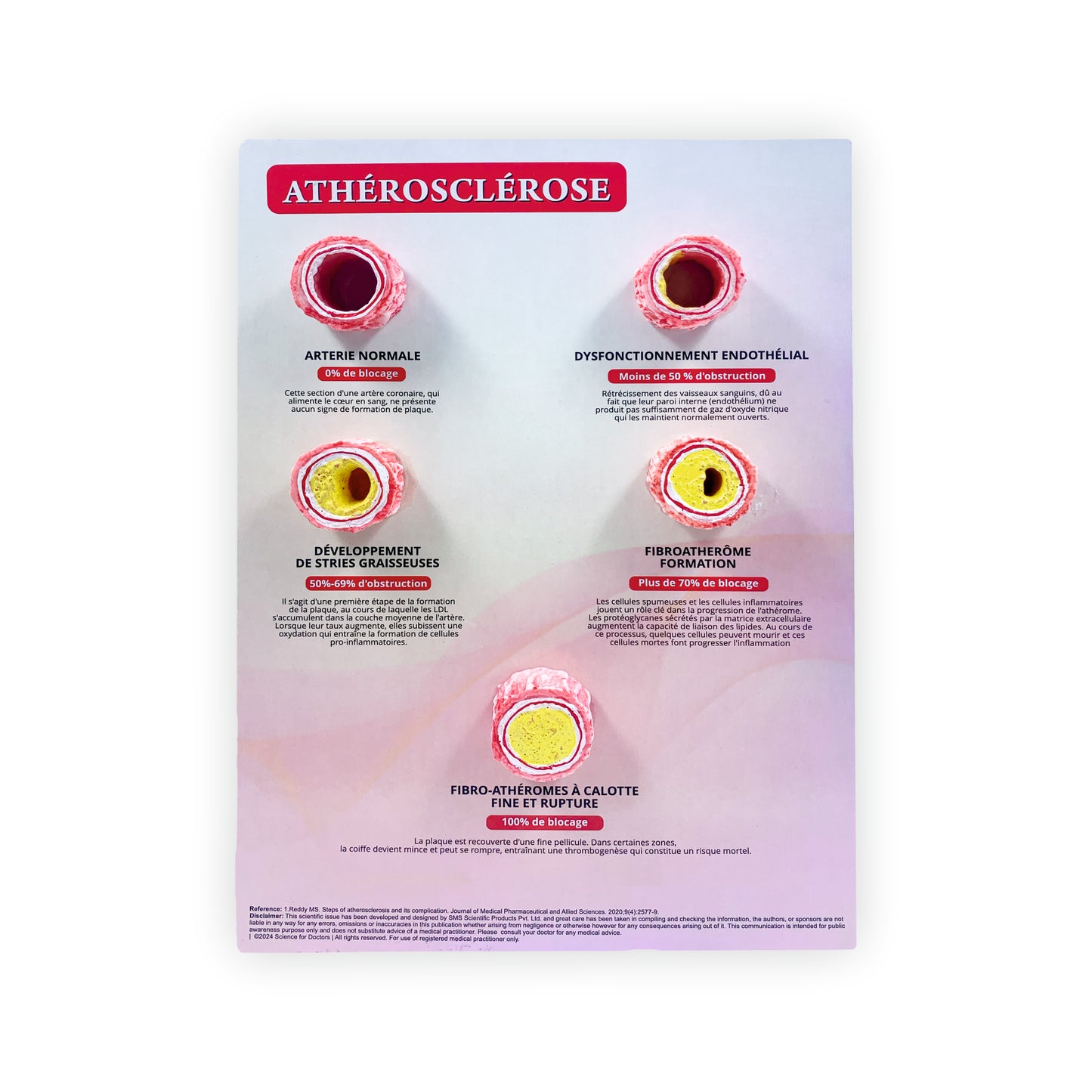 Atherosclerosis: 3D Therapy Board