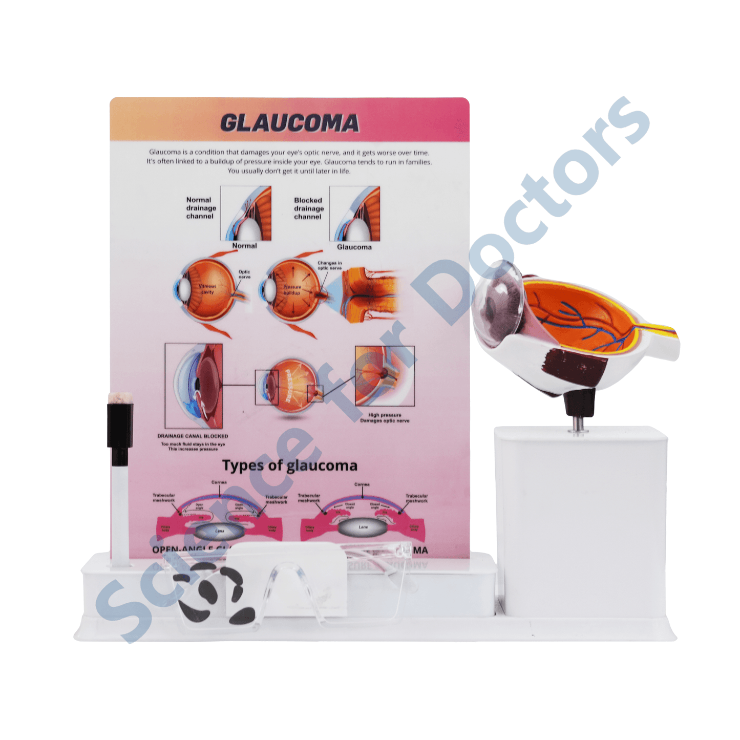 Glaucoma : 1 Slide write and wipe with anatomical model on stand