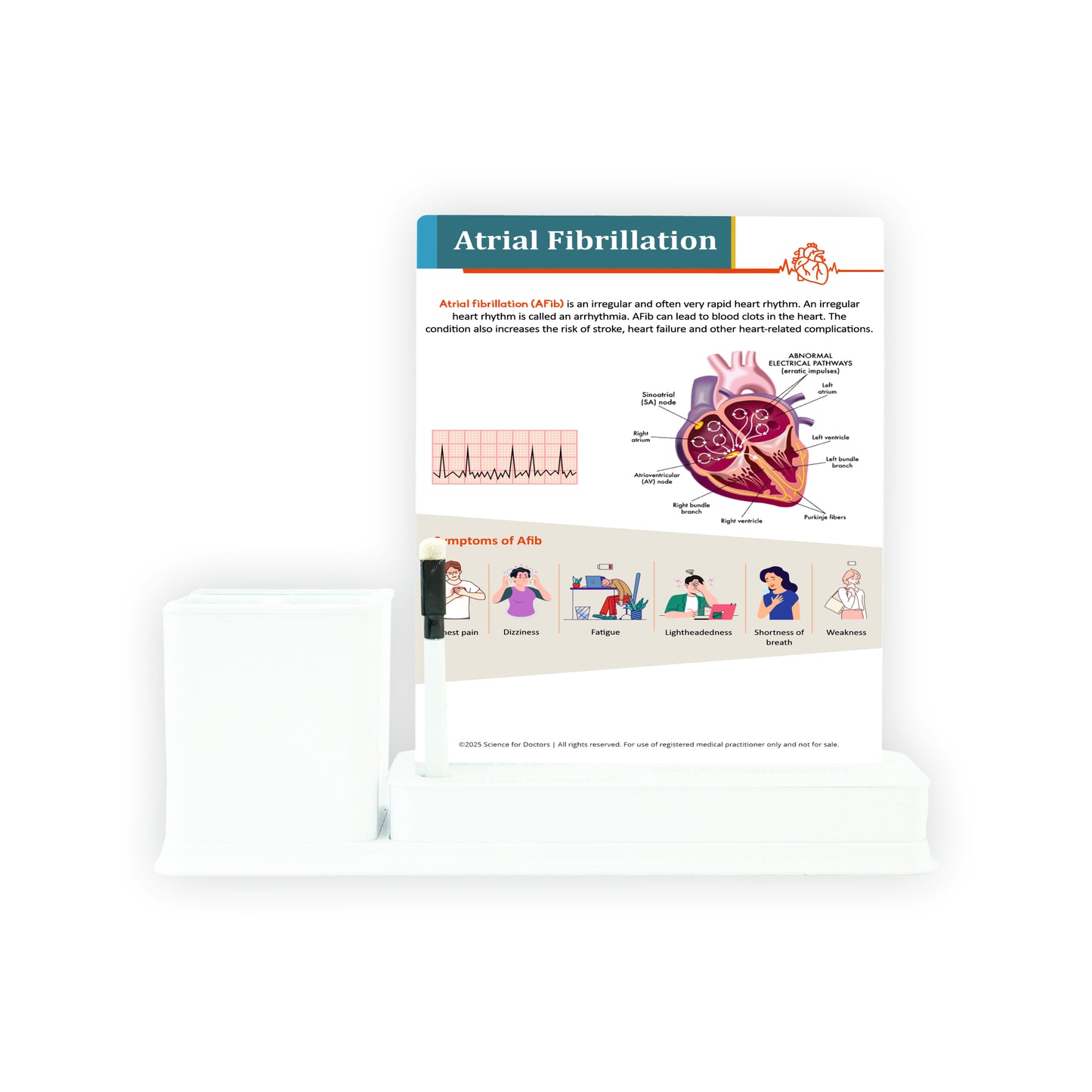 Atrial Fibrillation: 1 Slides Write & Wipe with Stationary Stand