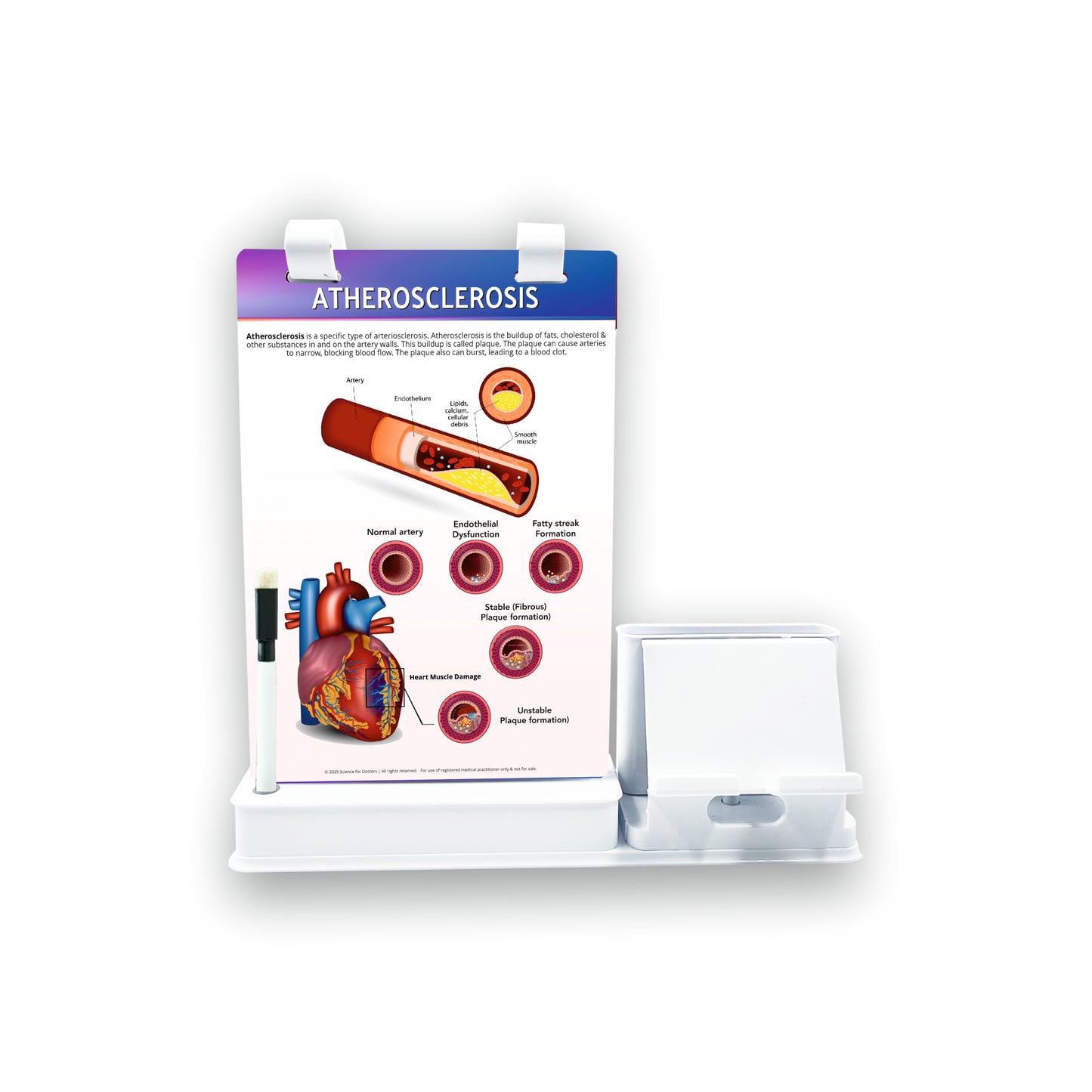 Smart -A5 Flip wipe With Mobile and Chit Pad Stand  - Atherosclerosis
