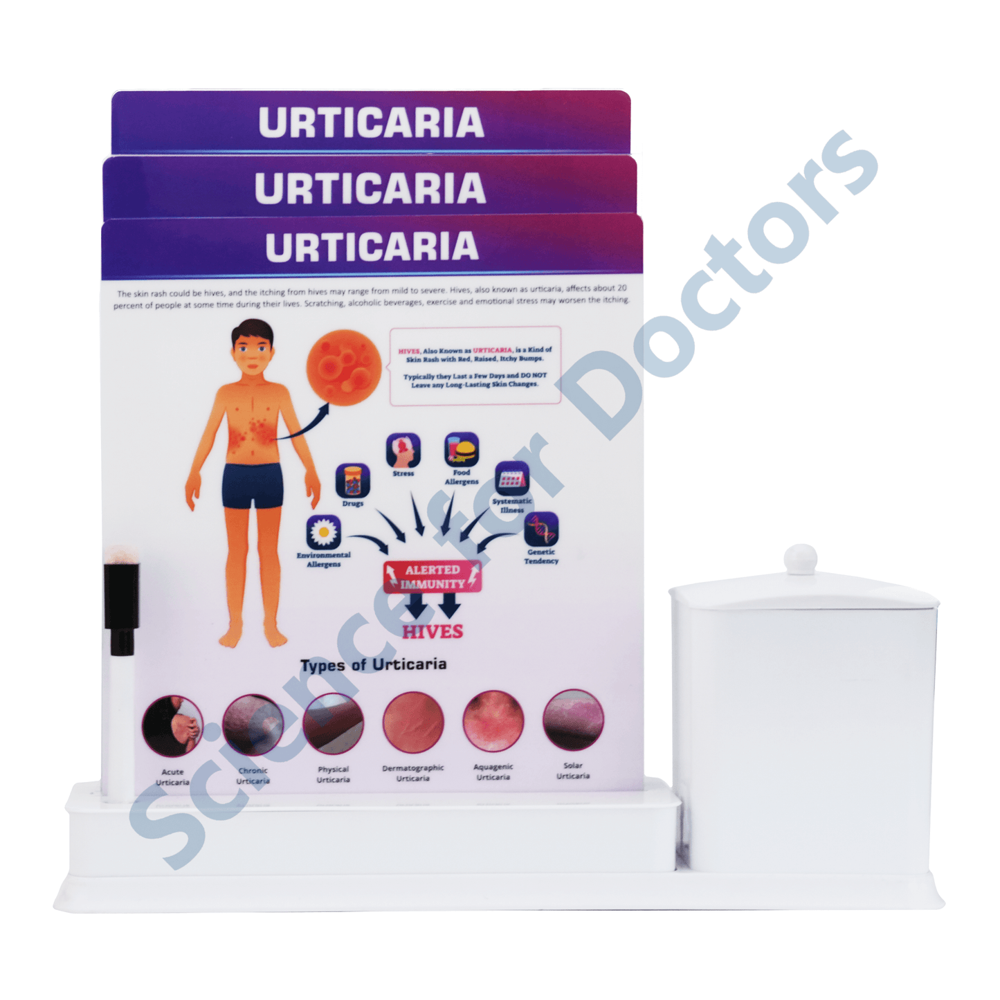 Urticaria: 3 Slides Write & Wipe with Stationary Stand