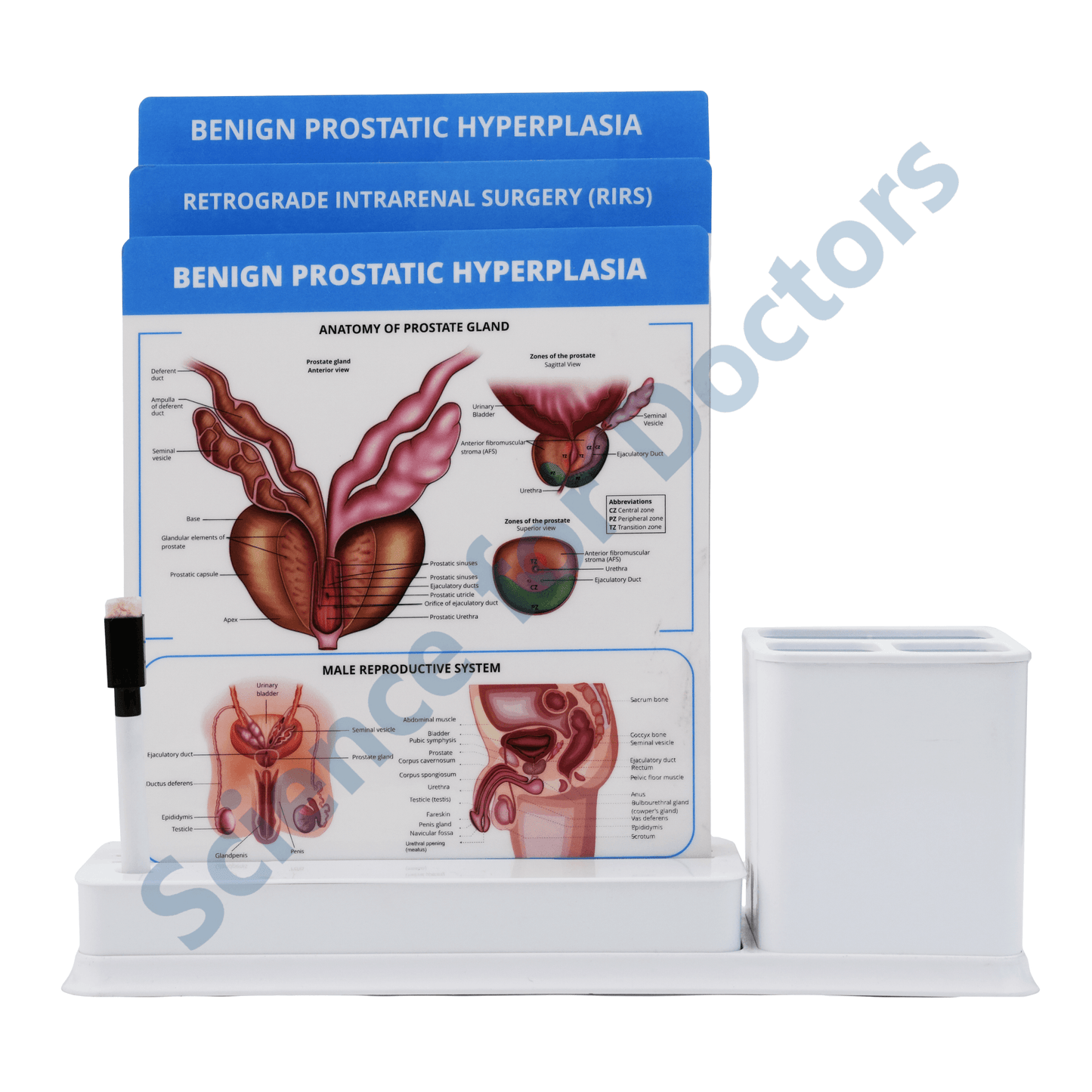 Benign Prostatic Hyperplasia: 3 Slides Write & Wipe with Stationary Stand