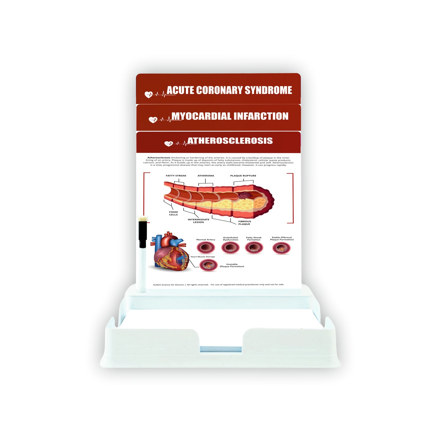 Atherosclerosis: 3 Slides With Tray