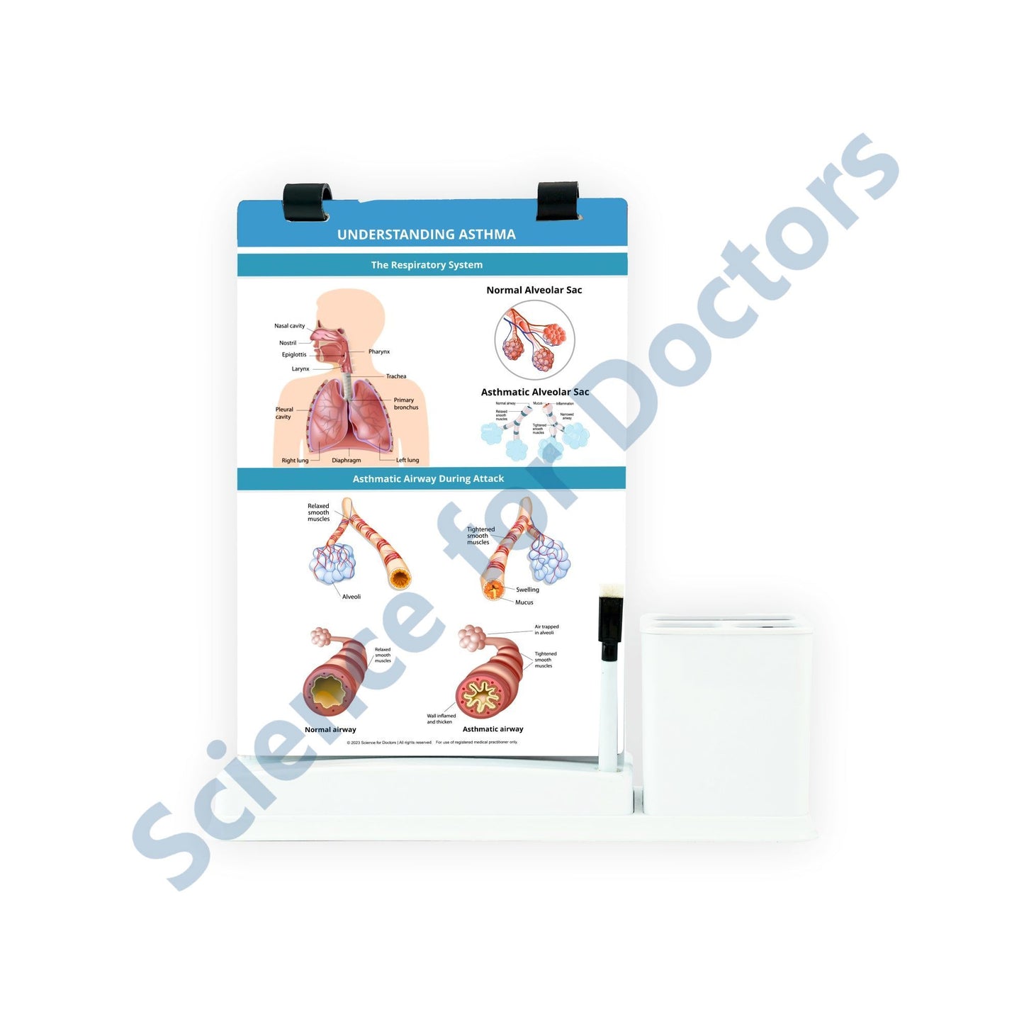 Understanding Asthma: A4 Flip Wipe With Stationary Stand