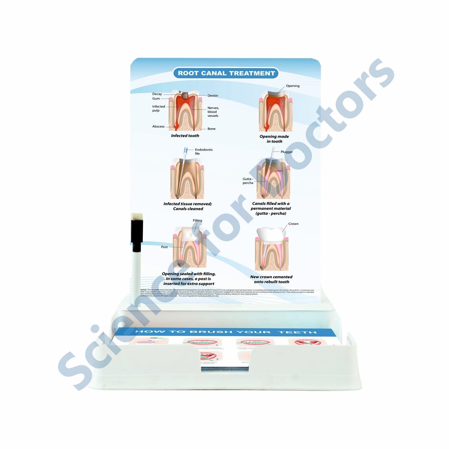 Root Canal Treatment: 1 Slide with Patient Leaflet Tray