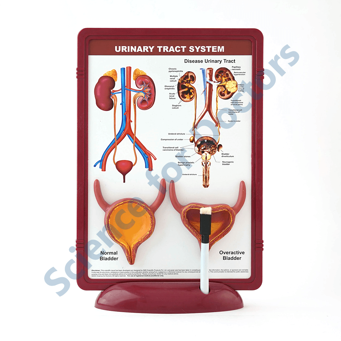 Urinary Tract System: 3D Therapy Frame