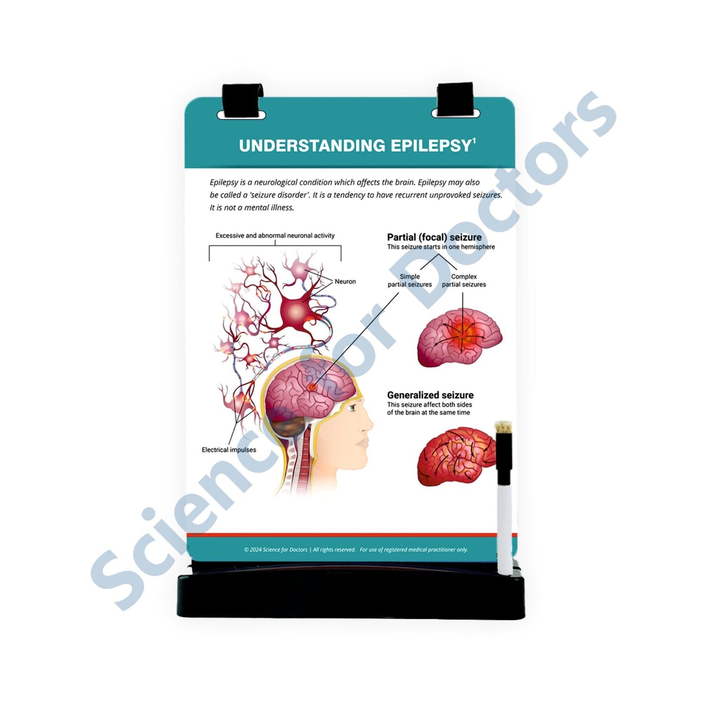 Understanding Epilepsy: A4 Flip Wipe