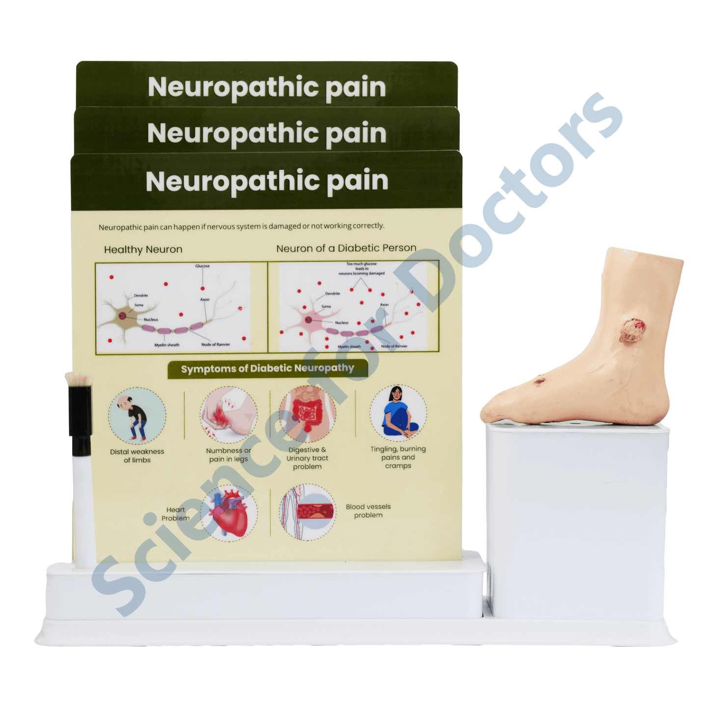 Neuropathic Pain : 3 Slide Write and Wipe with Anatomical Model on Stand