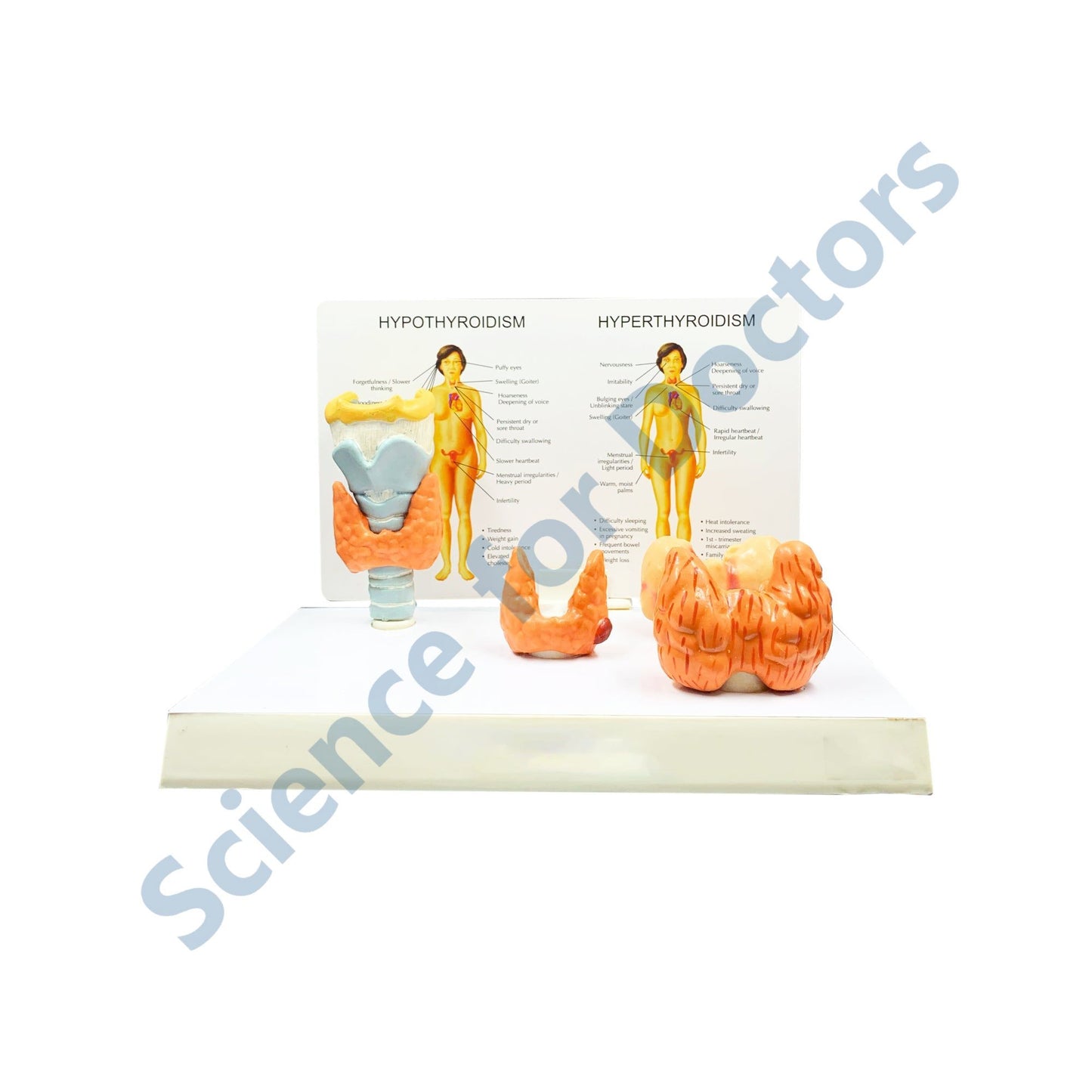 Hypothyroidism: 3D Anatomical Models