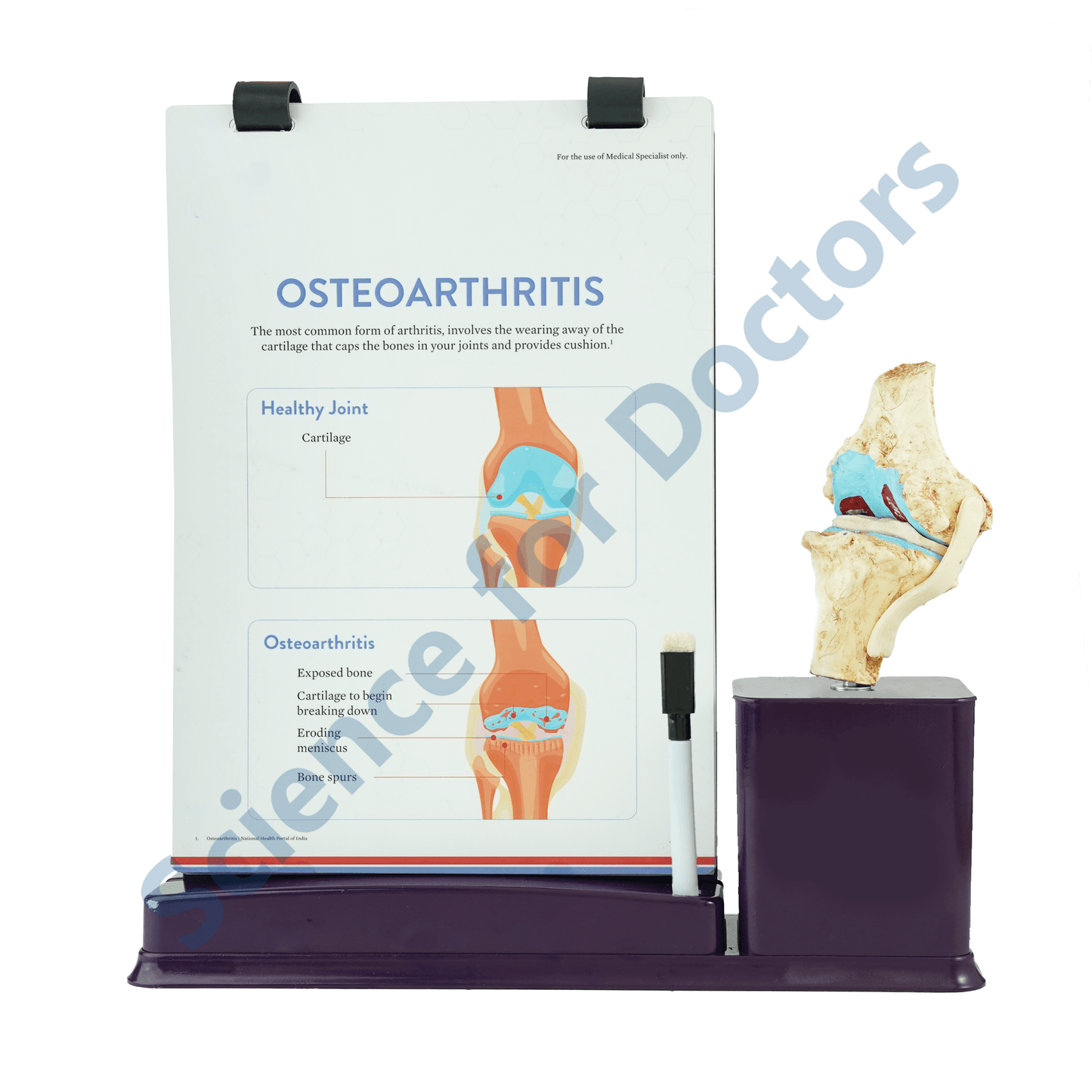 Osteoarthritis: A4 Flip Wipe With Anatomical Model