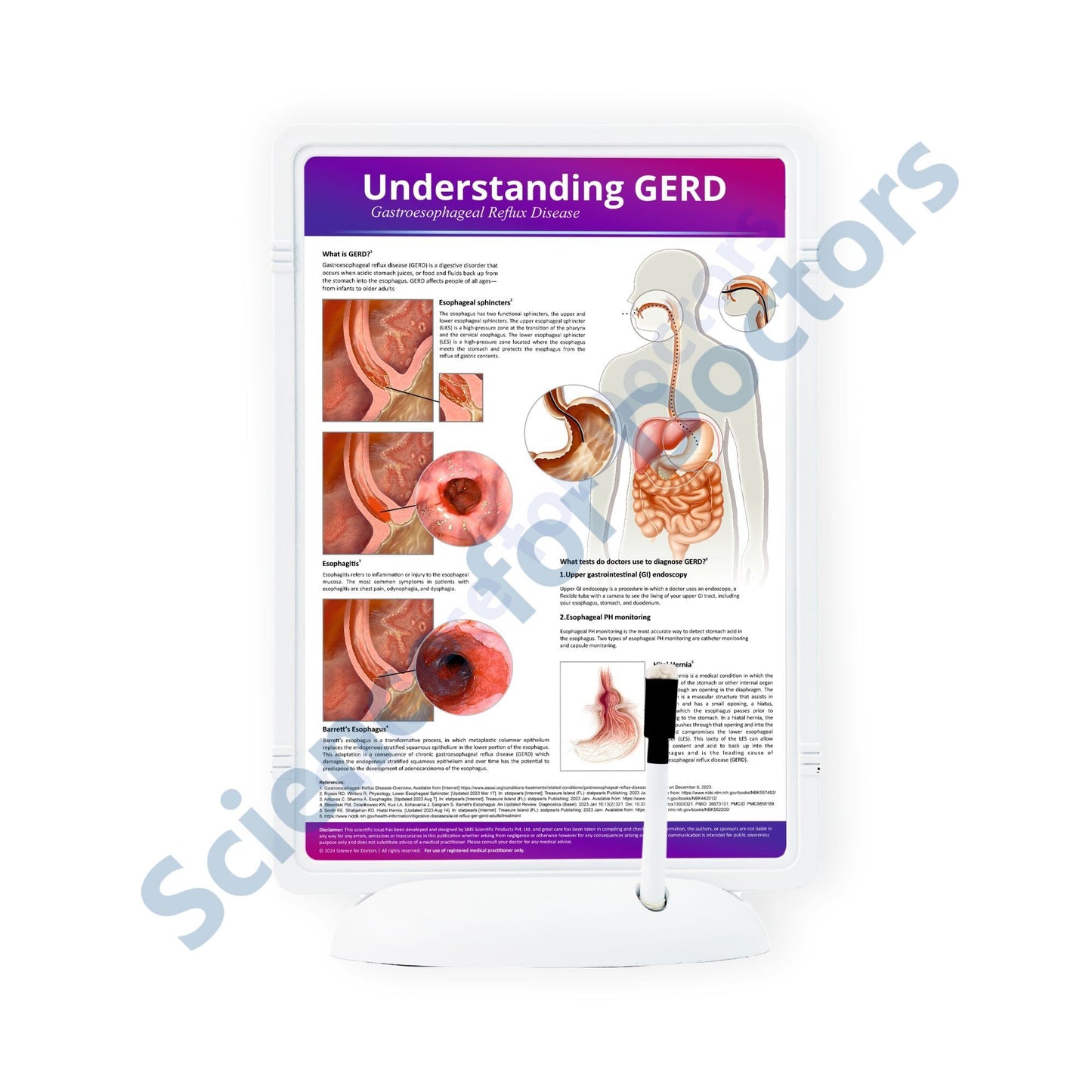 Understanding GERD: The Frame Write & Wipe