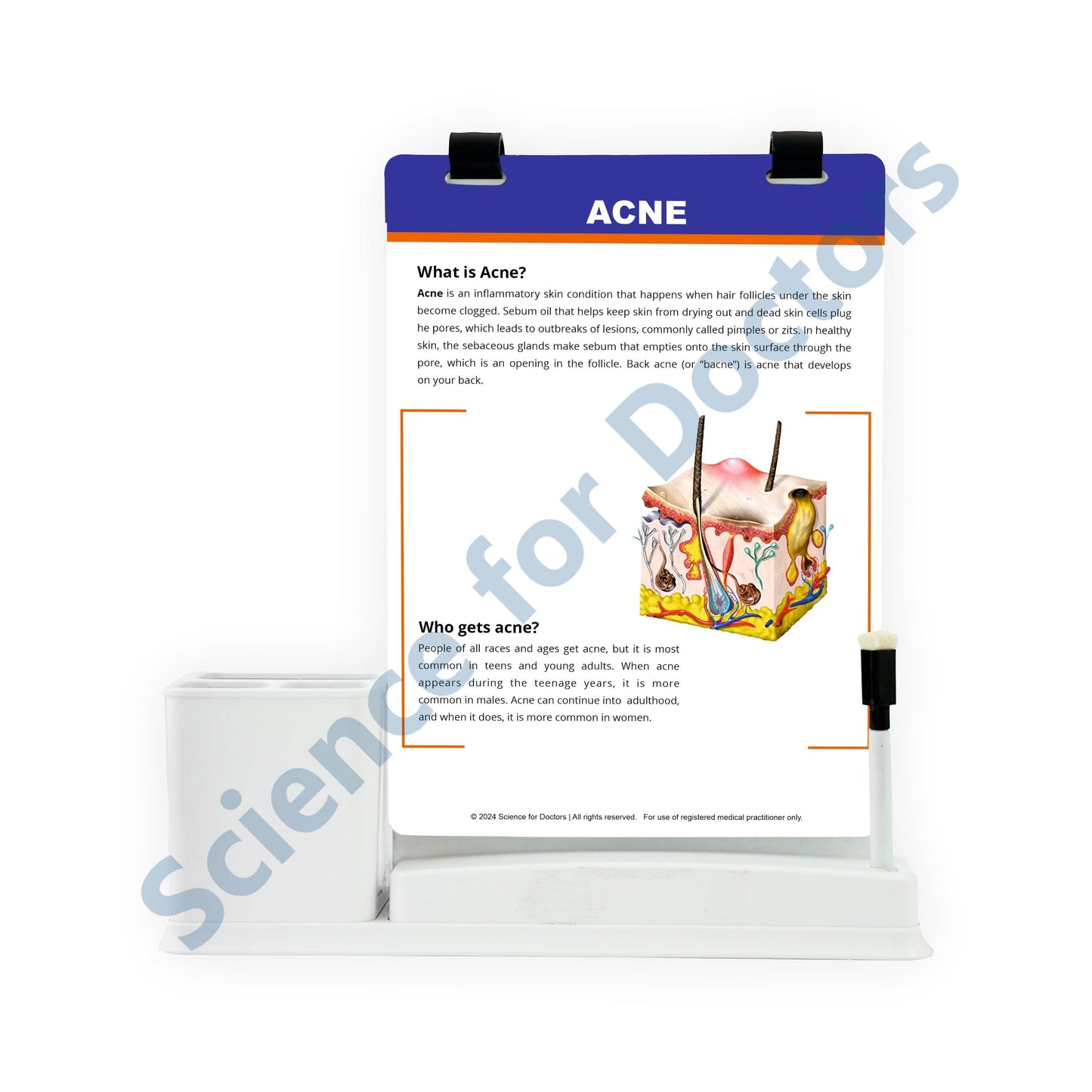 ACNE: A4 Flip Wipe With Stationary Stand