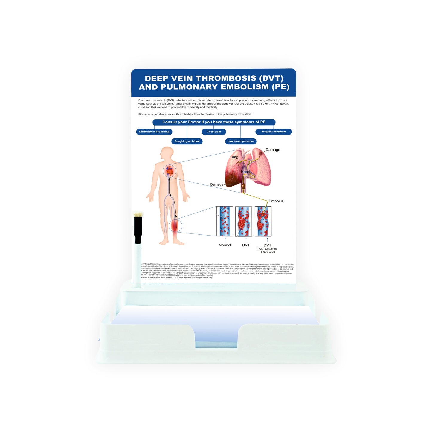 Deep Vein Thrombosis (DVT): 1 Slide with Patient Leaflet Tray