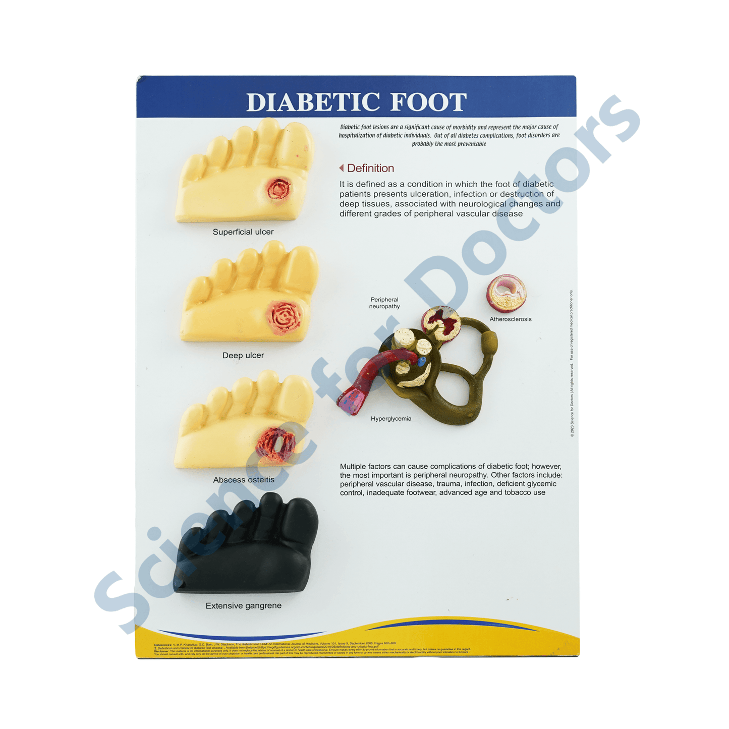 Diabetic Foot: 3D therapy Board