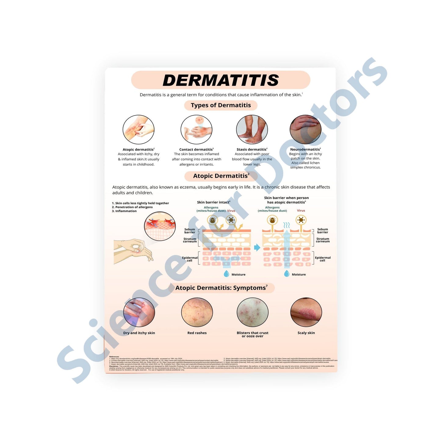 Dermatitis: Therapy Board