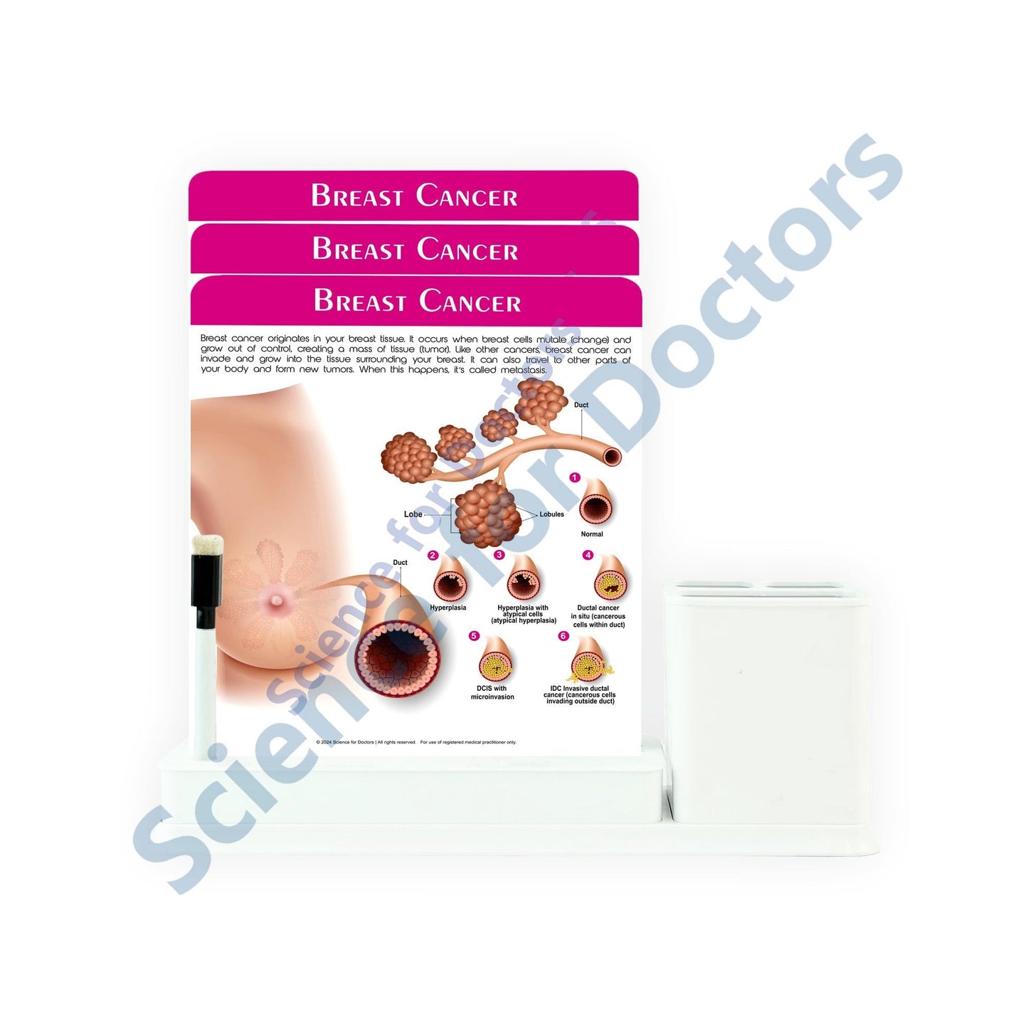 Breast Cancer: 3 Slides Write & Wipe with Stationary Stand