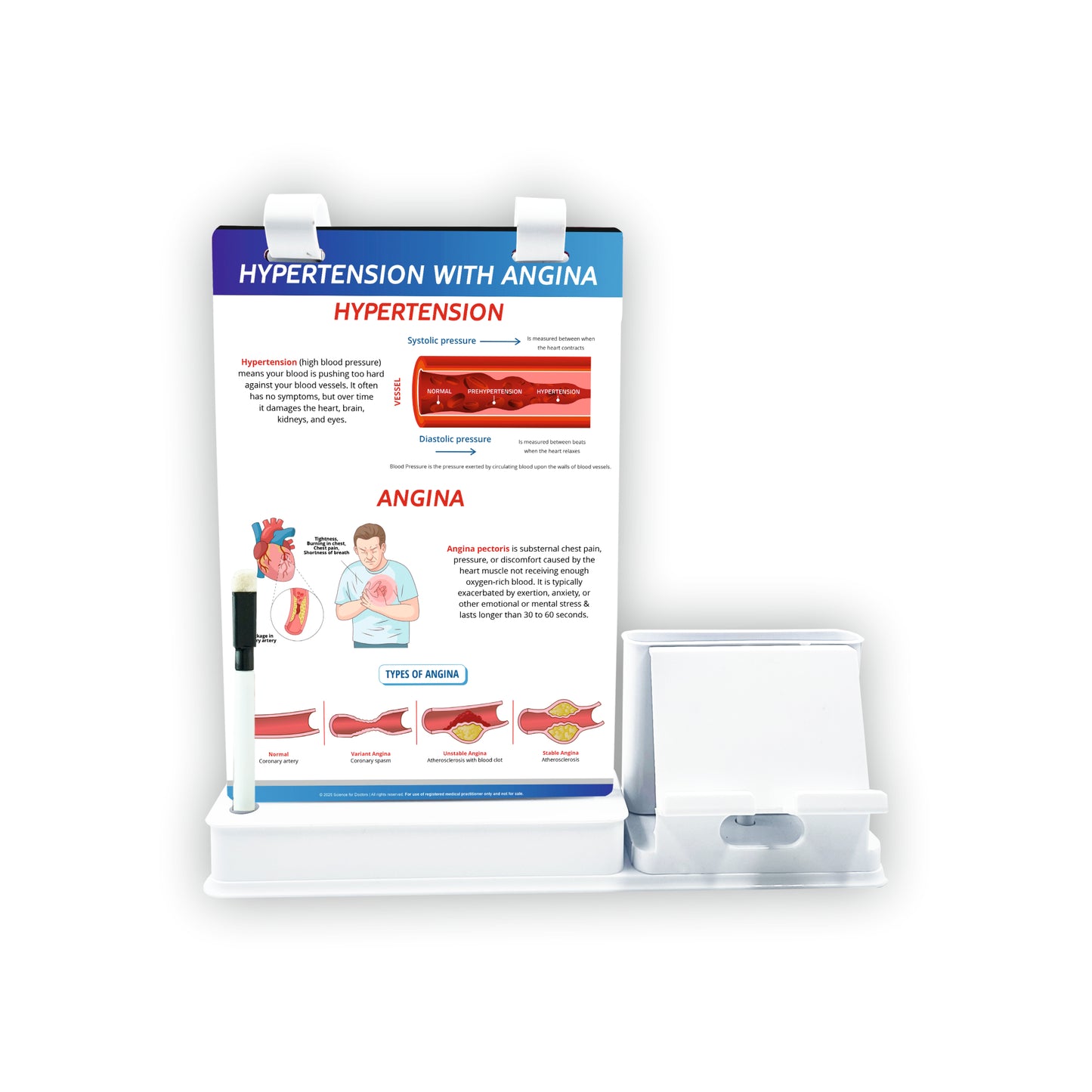 Smart -A5 Flip wipe With Mobile and Chit Pad Stand  - HYPERTENSION WITH ANGINA