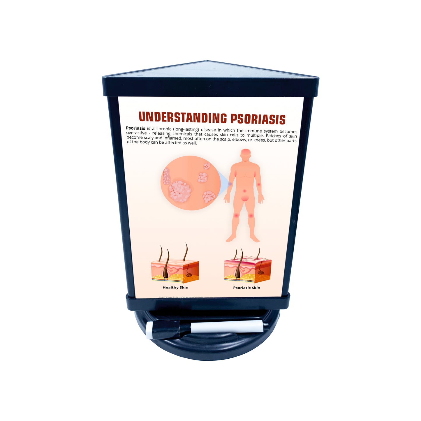 Rotri V - Understanding PSORIASIS