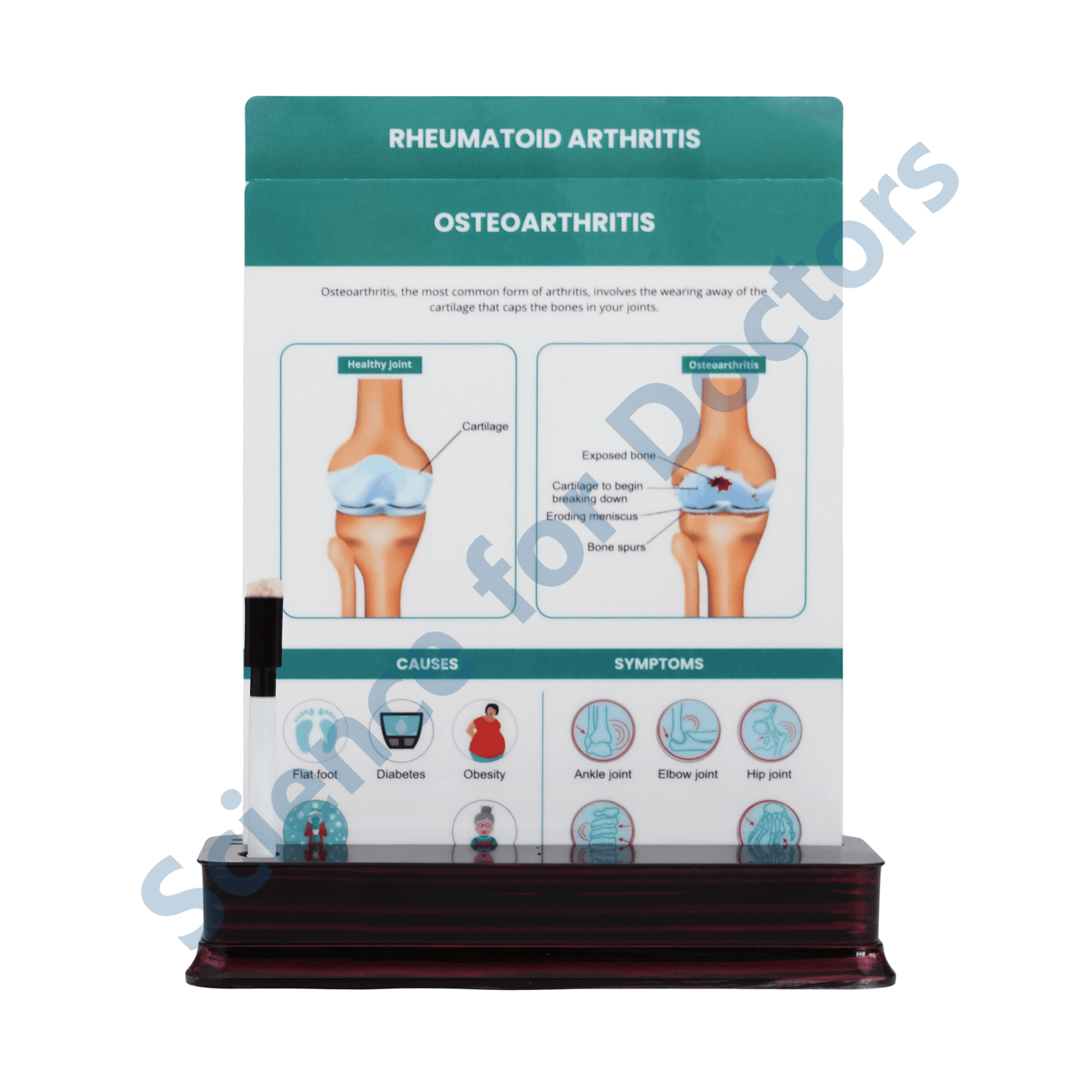 Osteoarthritis: 2 slide on stand