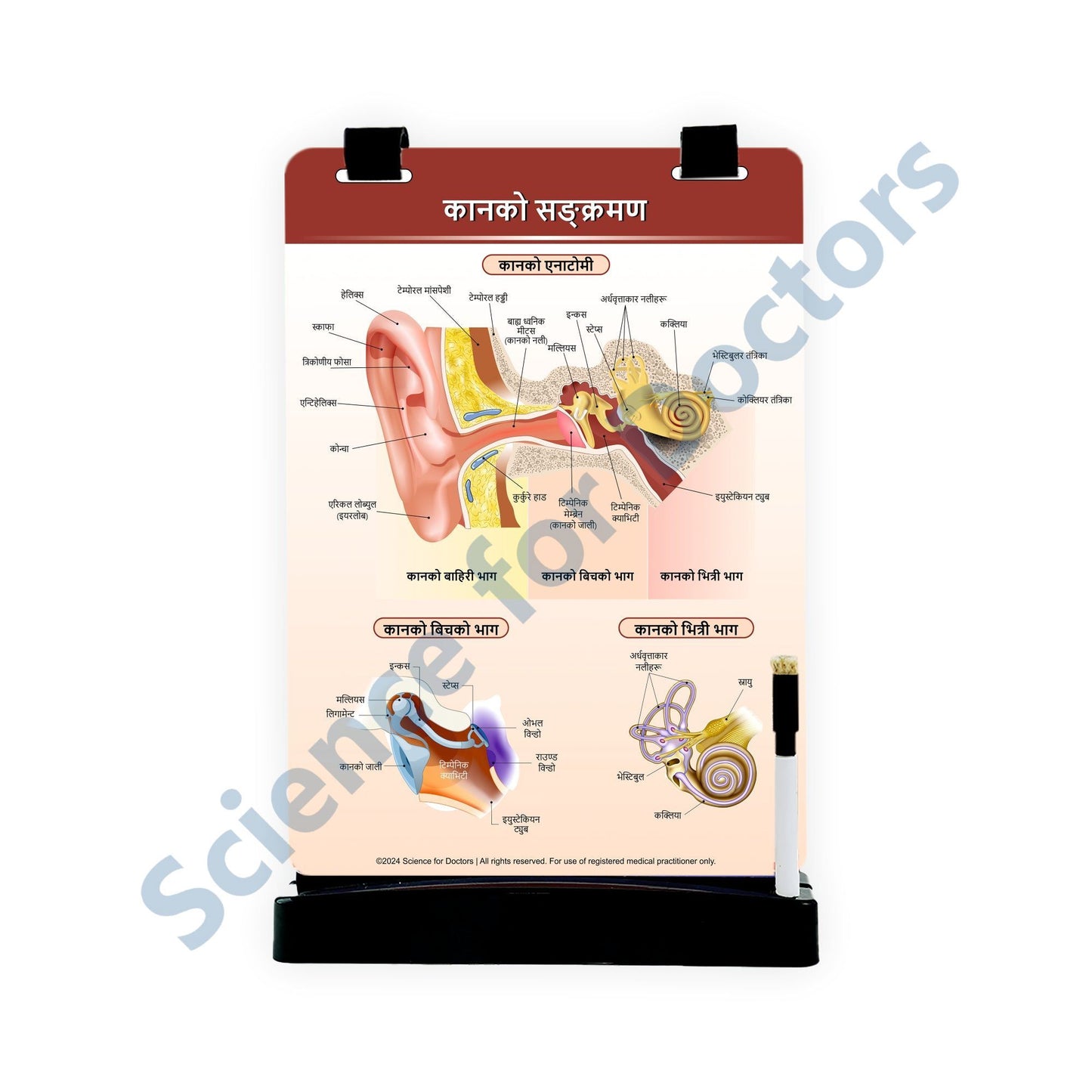 Ear infections: A4 Flip Wipe