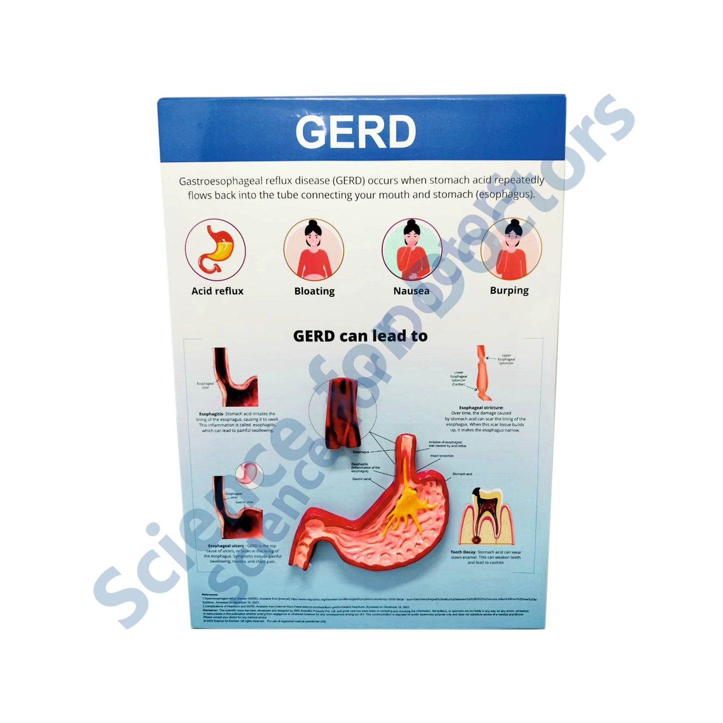 GERD: 3D Therapy Board