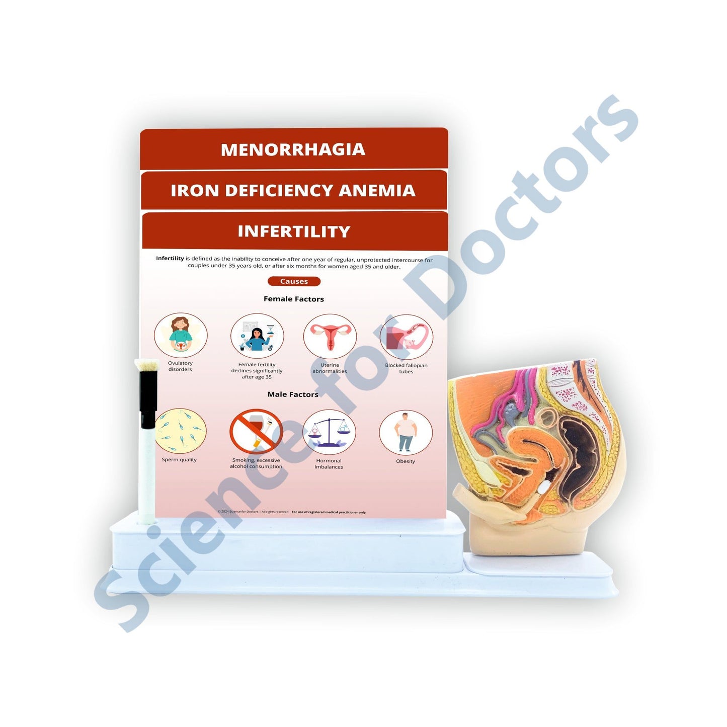 Infertility: 3 Slides Write & Wipe With Model On Stand