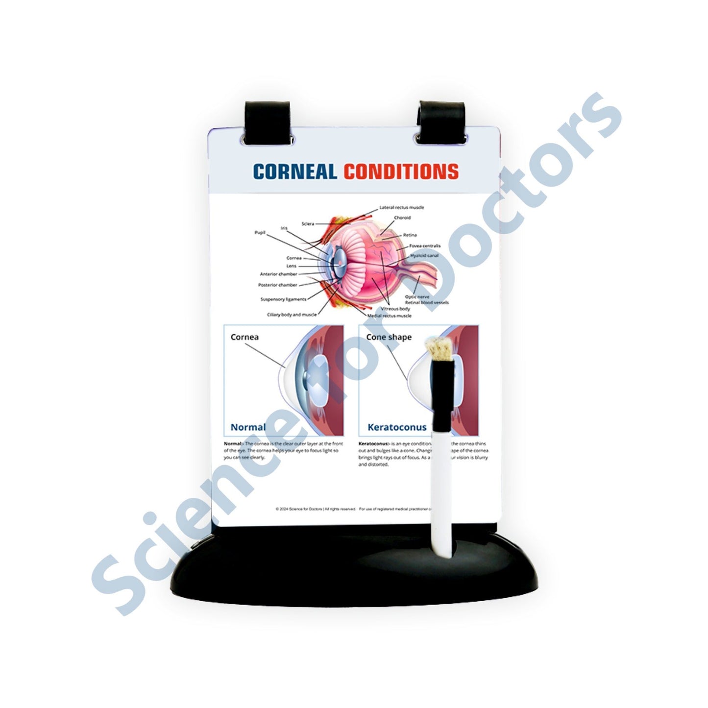 Corneal Conditions: A5 Flip Wipe