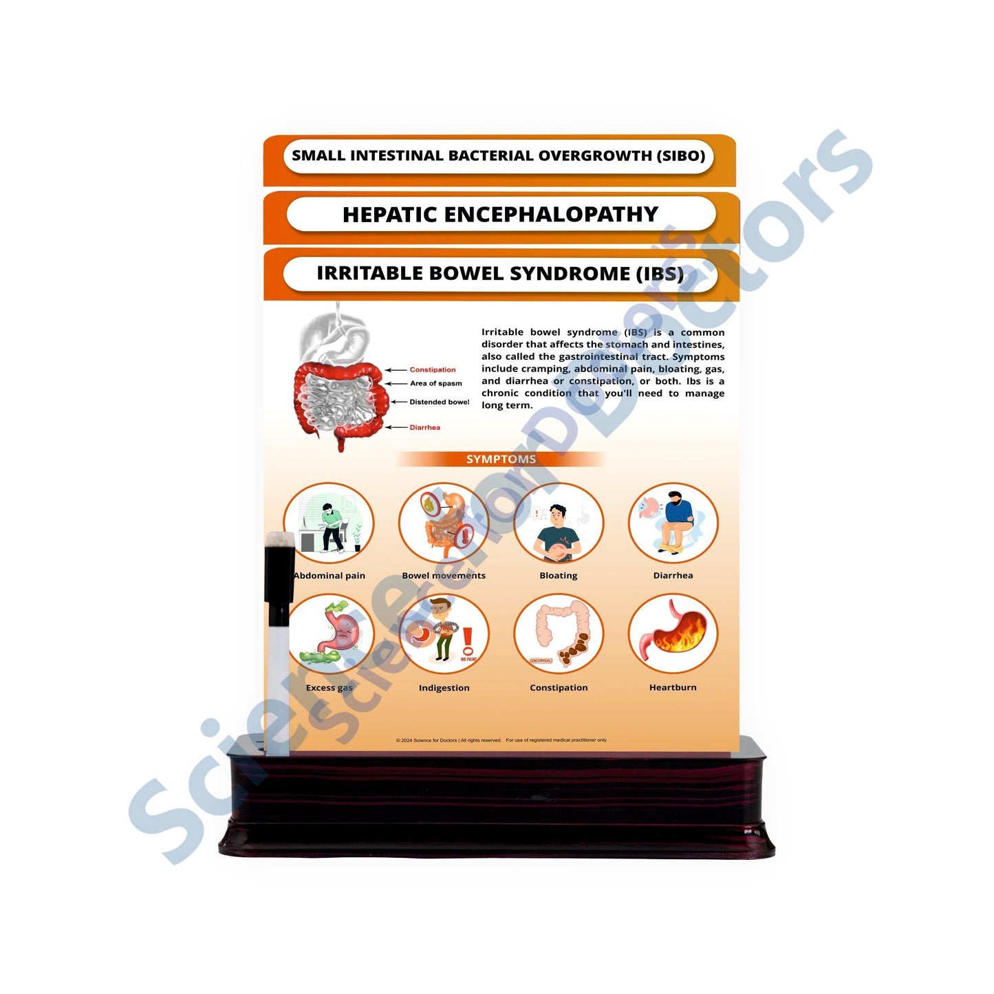 Irritable Bowel Syndrome (IBS): 3 Slides on Stand