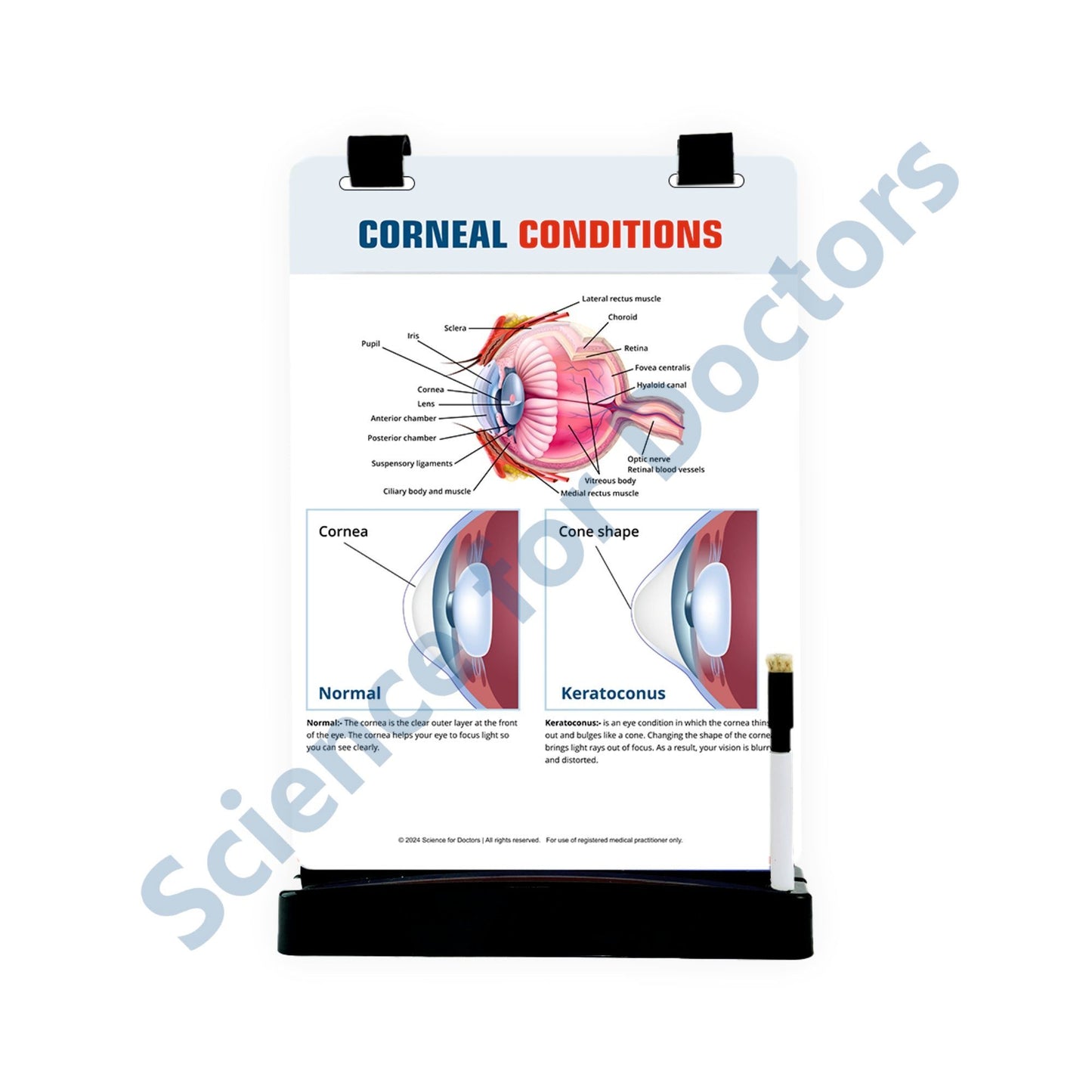 Corneal Conditions: A4 Flip Wipe