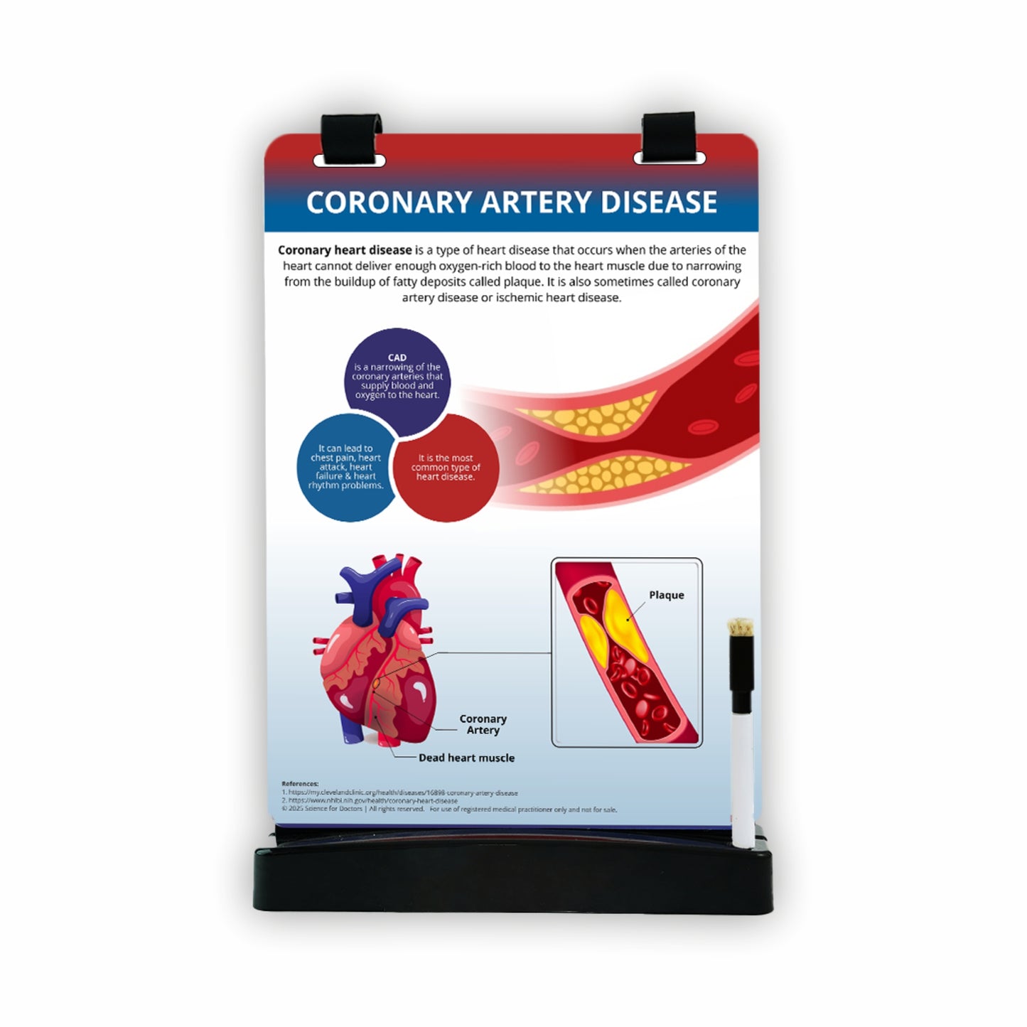 Coronary Artery Disease: A4 Flip Wipe