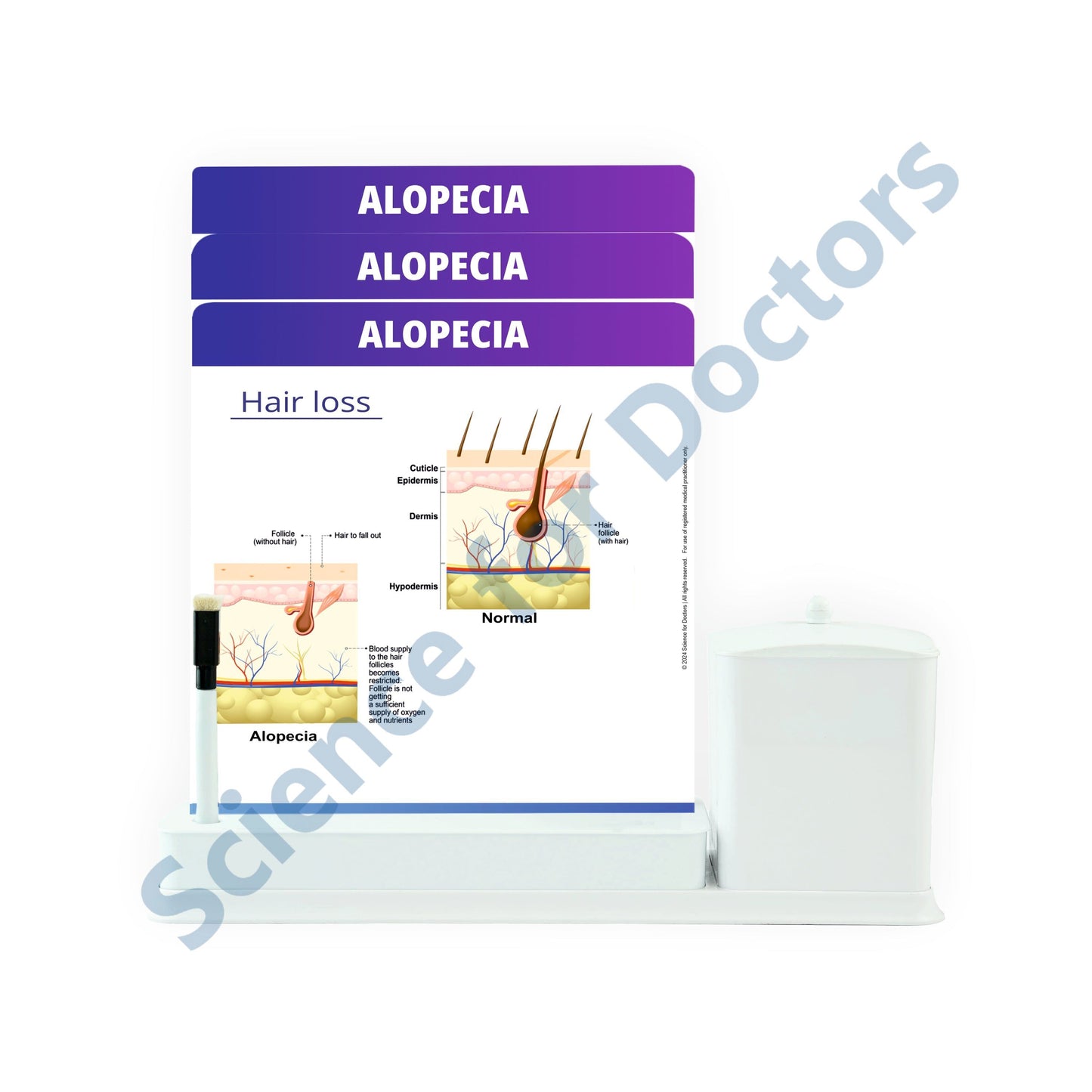 ALOPECIA: 3 Slides Write Wipe With Utility Container