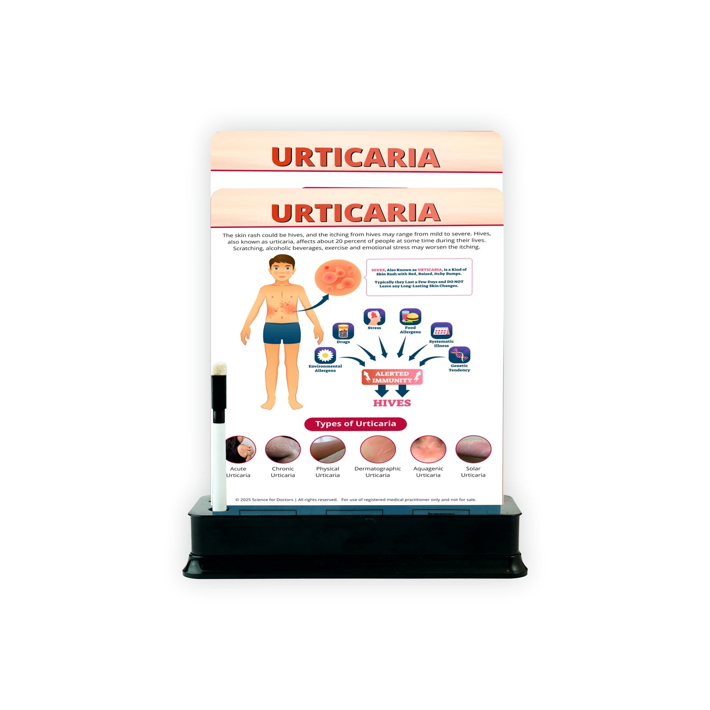 Urticaria: 2 Slides With Stand