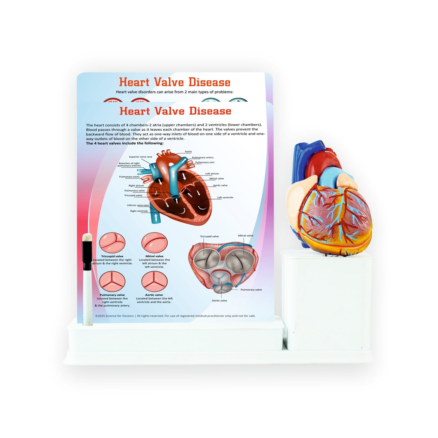 Heart Valve Disease: 2 Slides Write & Wipe with Anatomical Model on Stationary Stand