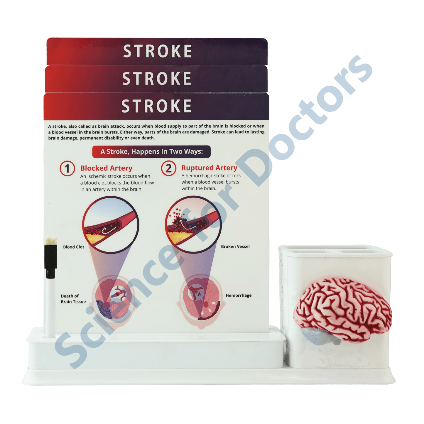 Stroke : 1 Slide Write and wipe with anatomical model on stationery stand