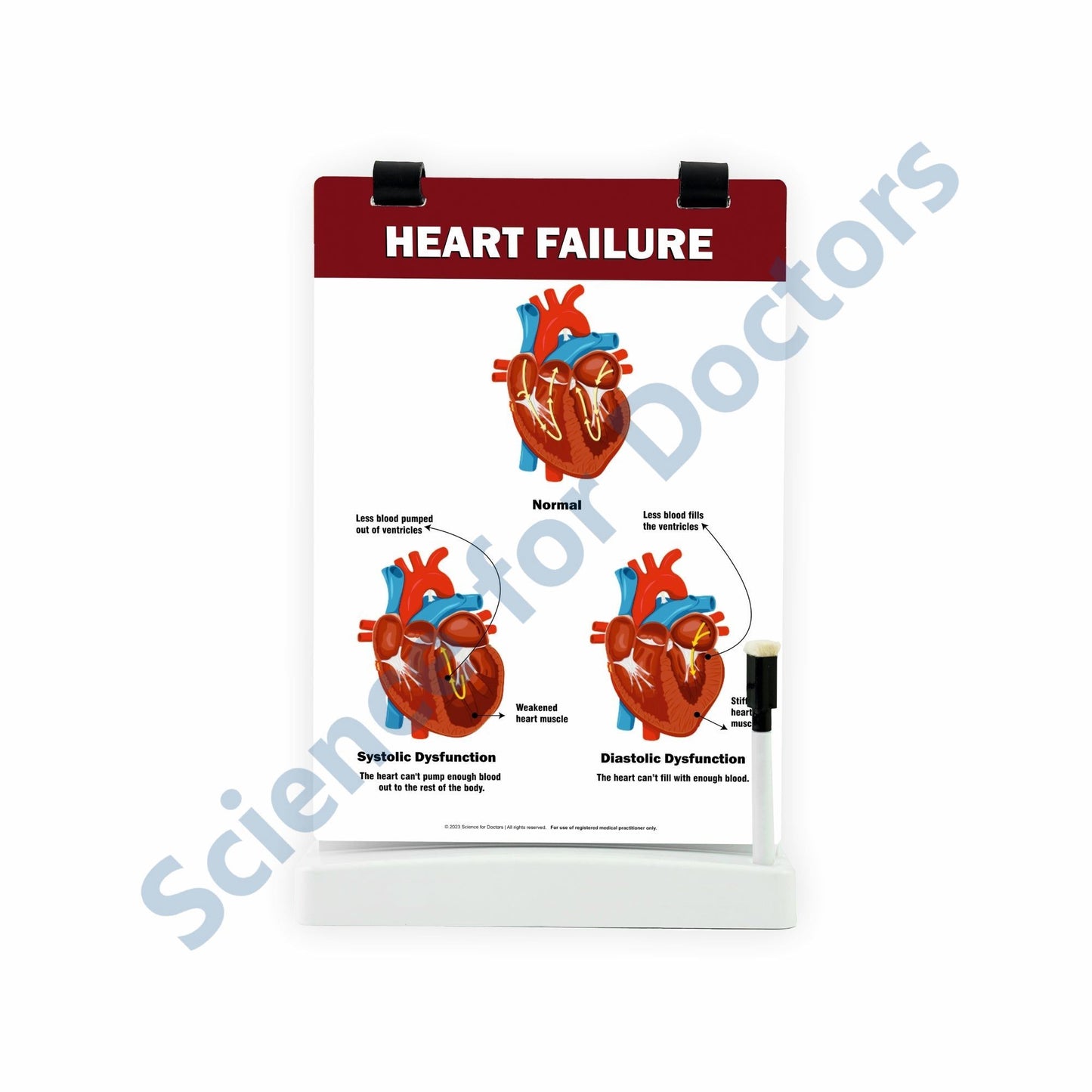 Heart Failure: A4 Flip Wipe